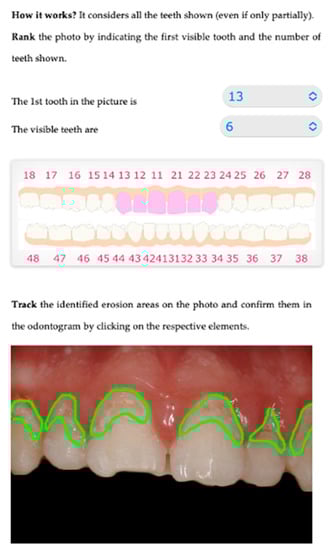 Sensors 22 05133 g005 550