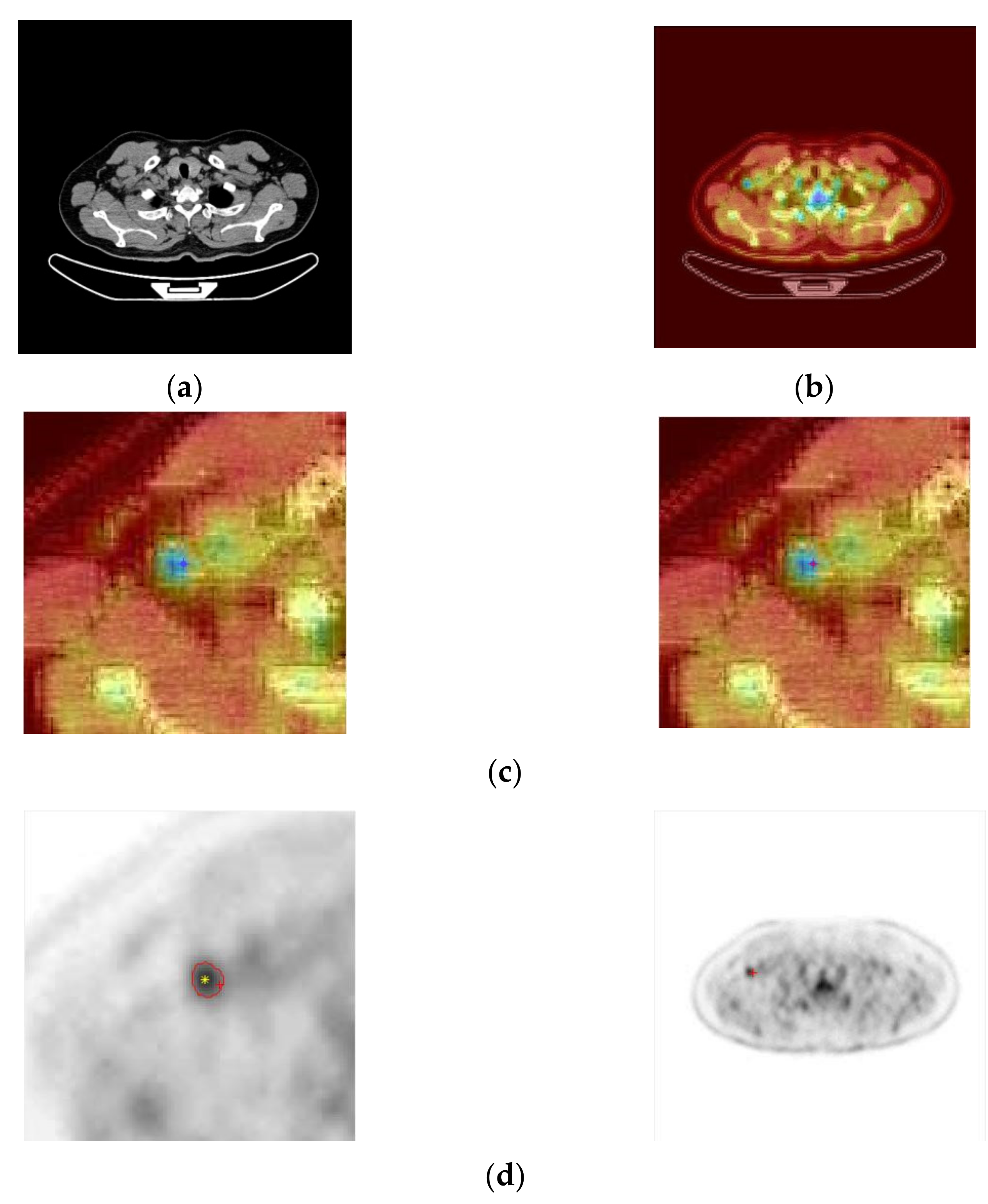 Sensors 22 05171 g006