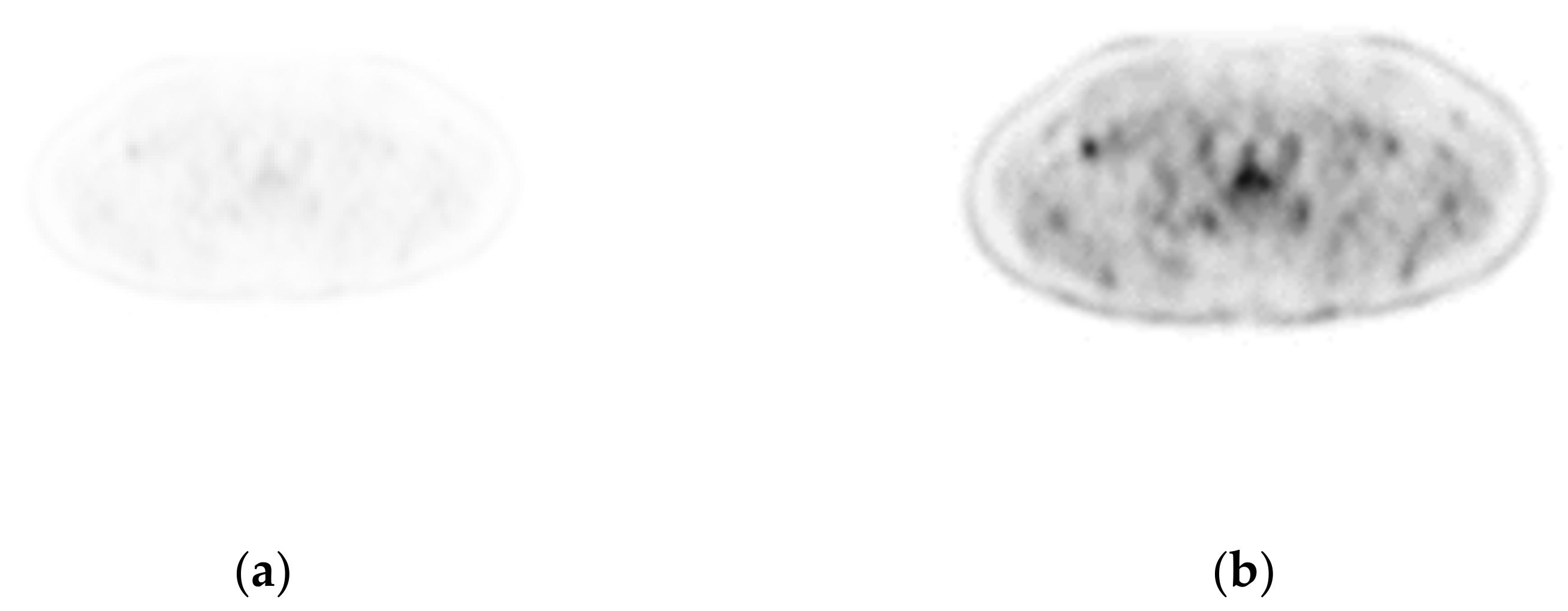 Sensors 22 05171 g007