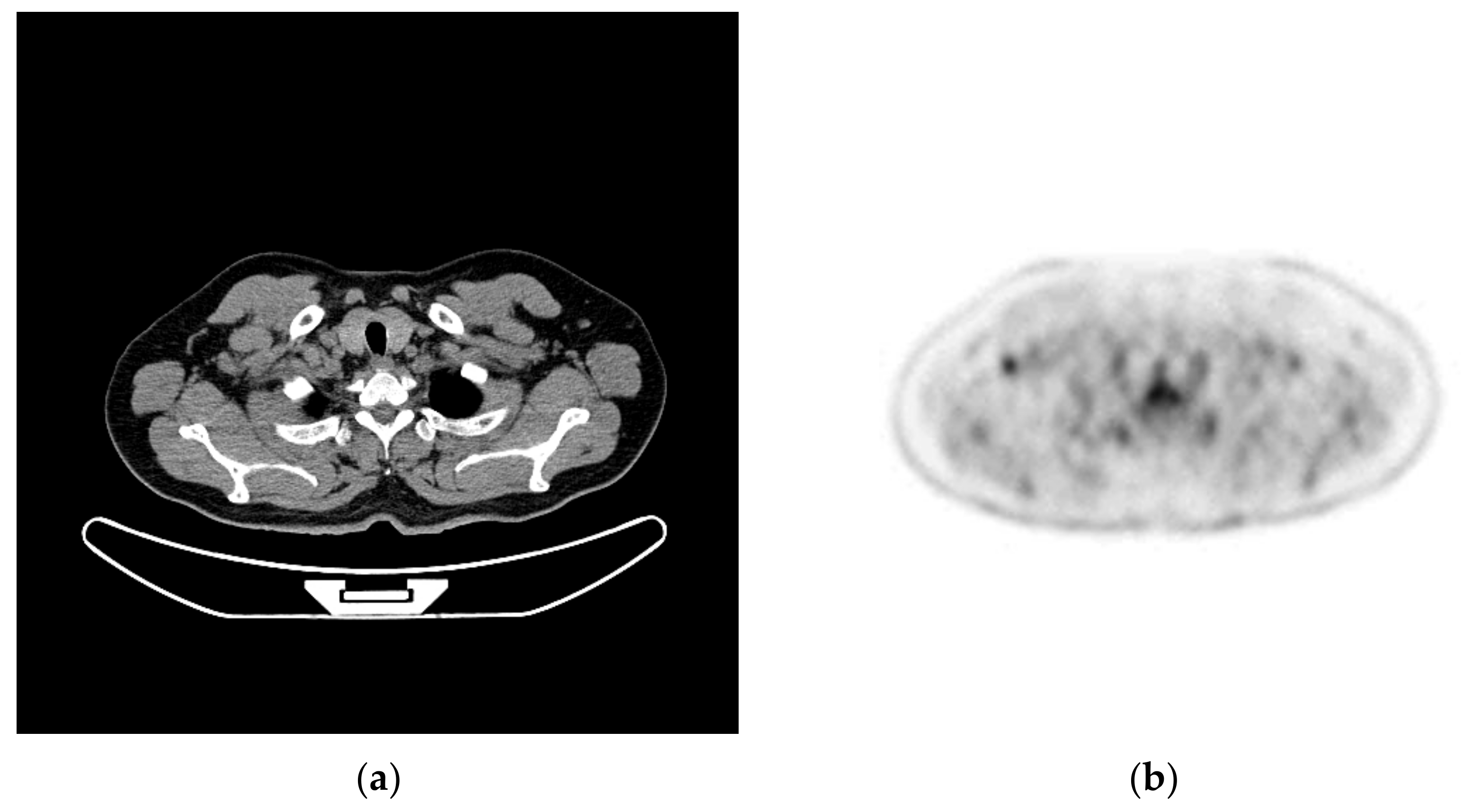 Sensors 22 05171 g008