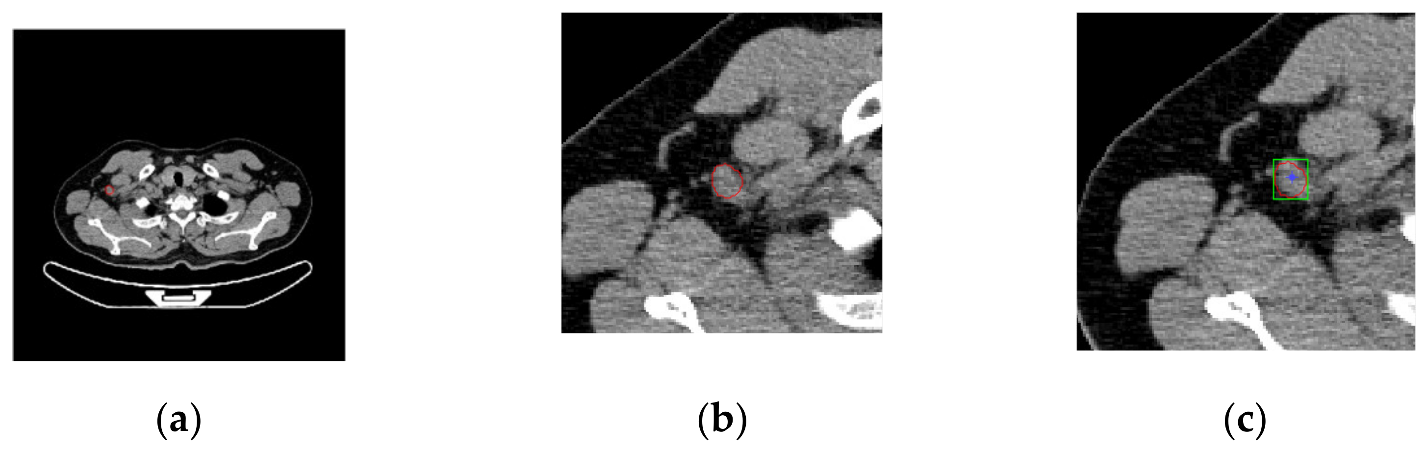 Sensors 22 05171 g010