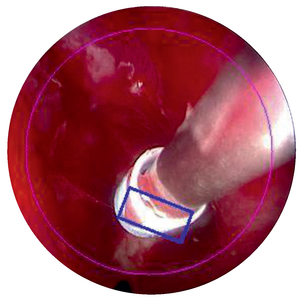 Sensors 22 05175 g006