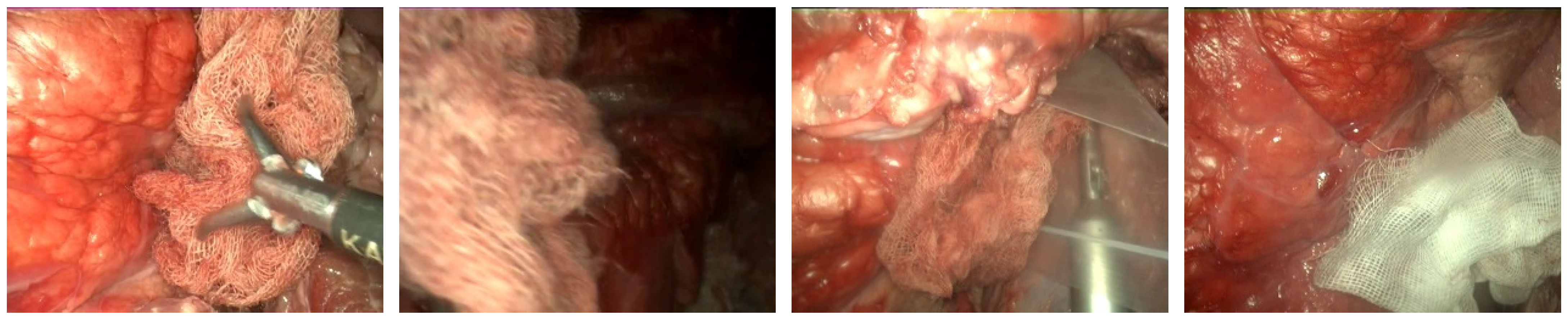 Sensors 22 05180 g002