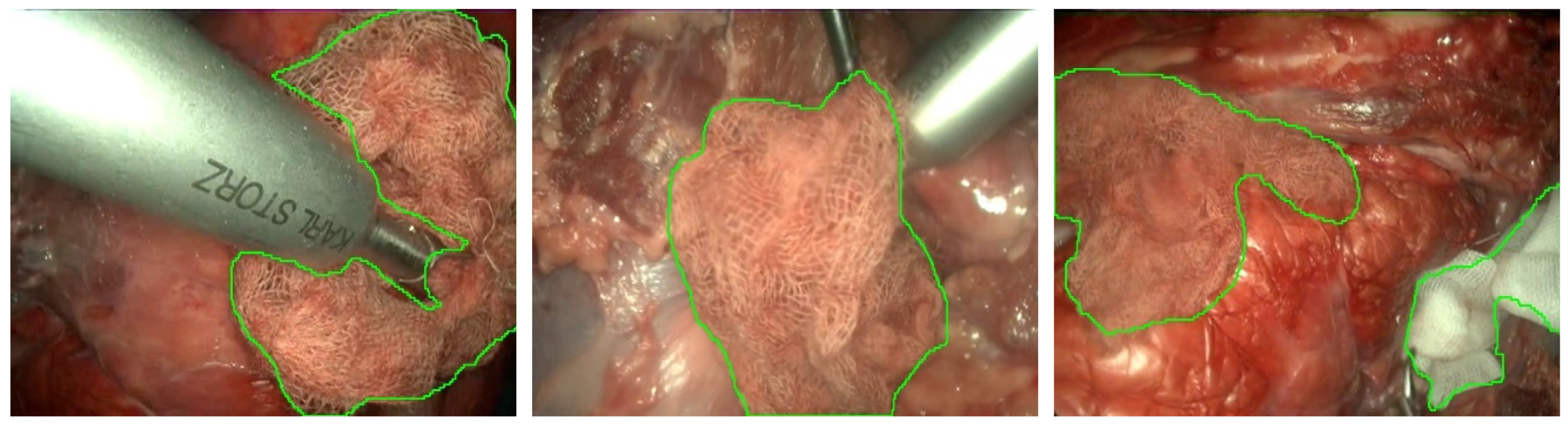 Sensors 22 05180 g003