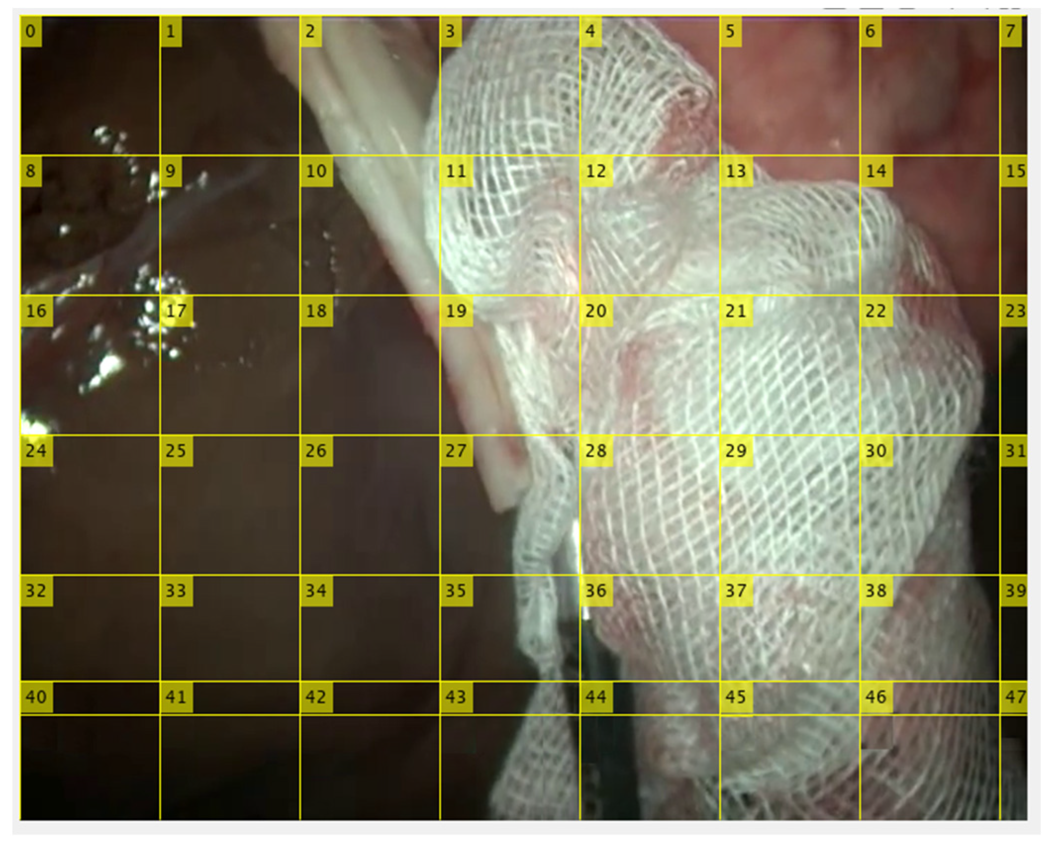 Sensors 22 05180 g004