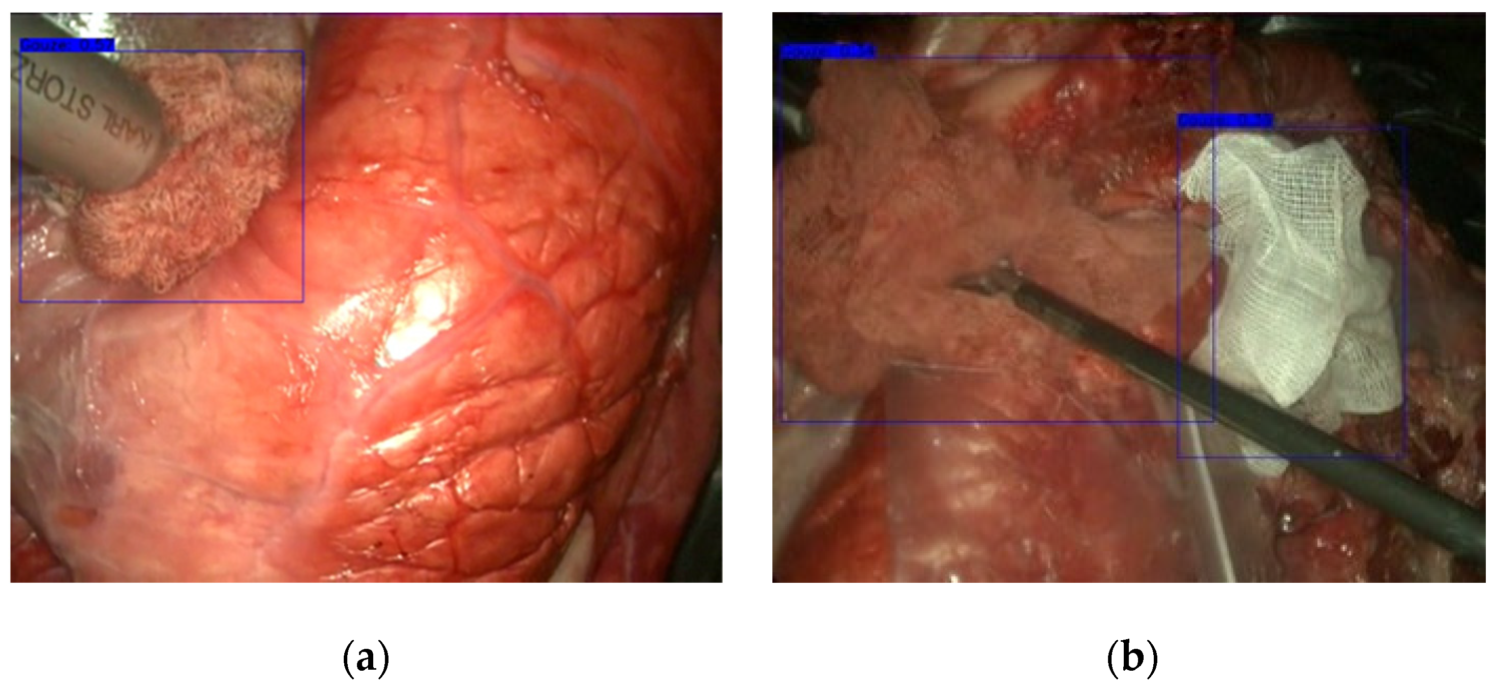 Sensors 22 05180 g005