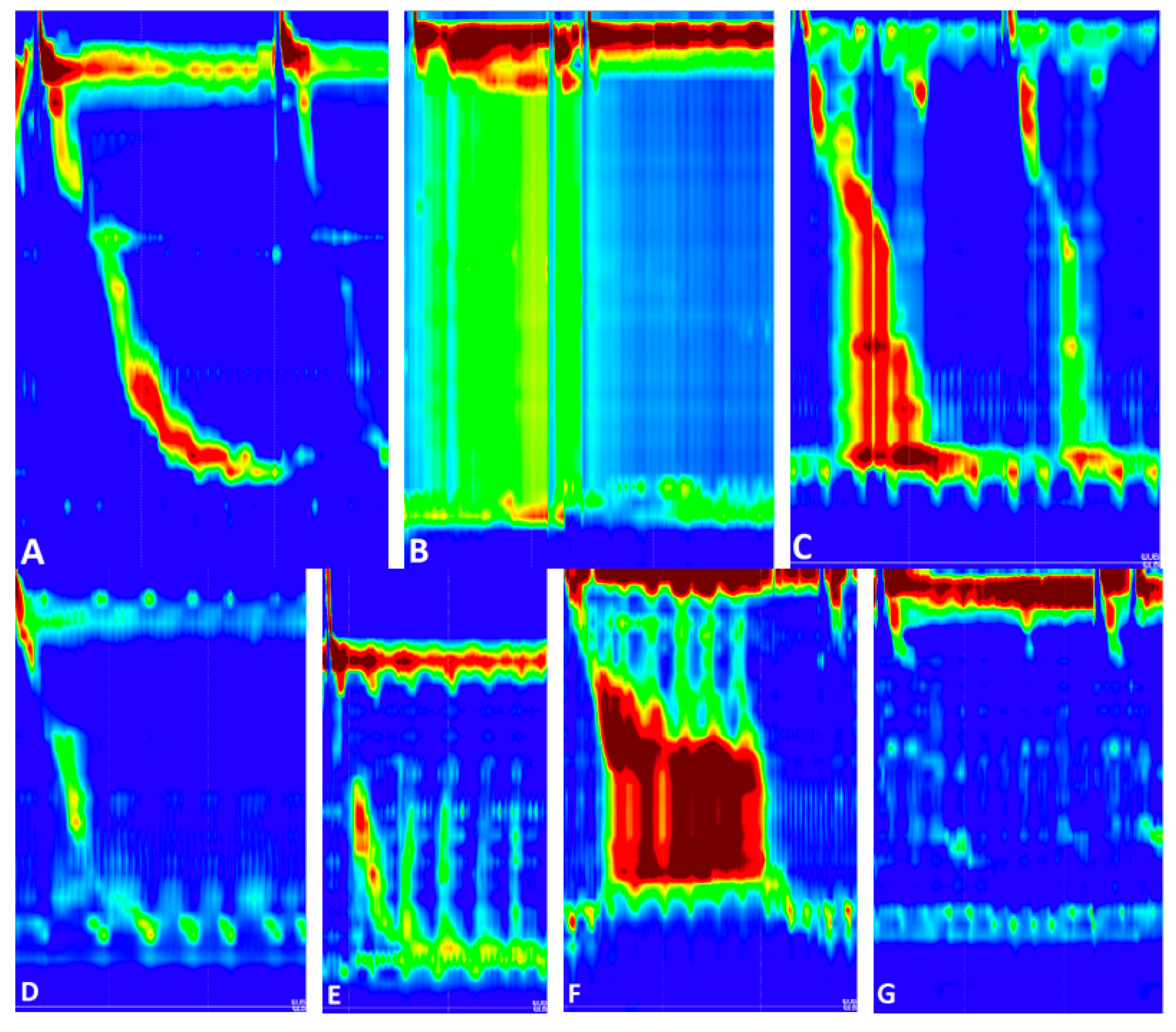 Sensors 22 05227 g002