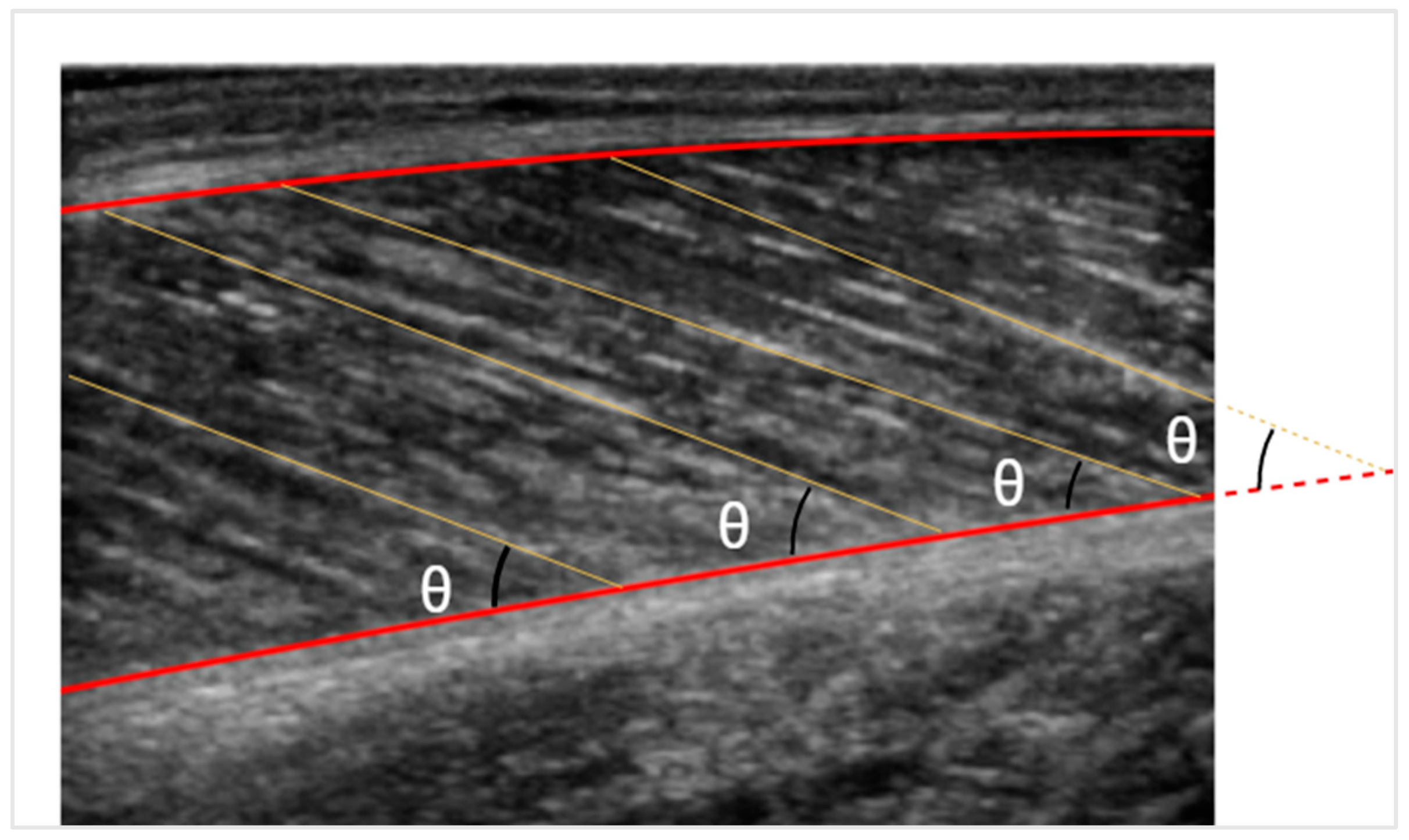 Sensors 22 05230 g006