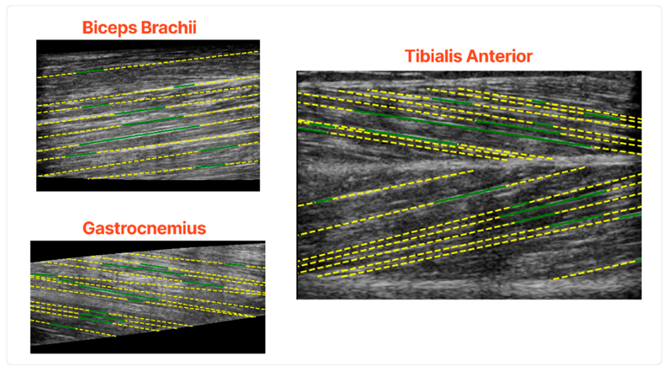 Sensors 22 05230 g008
