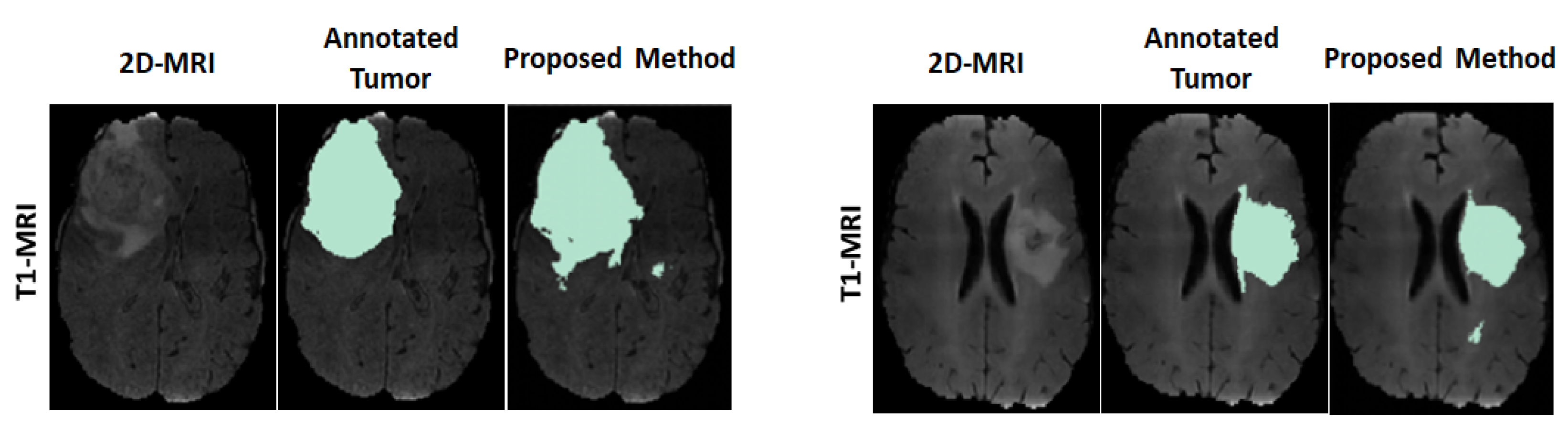 Sensors 22 05292 g004