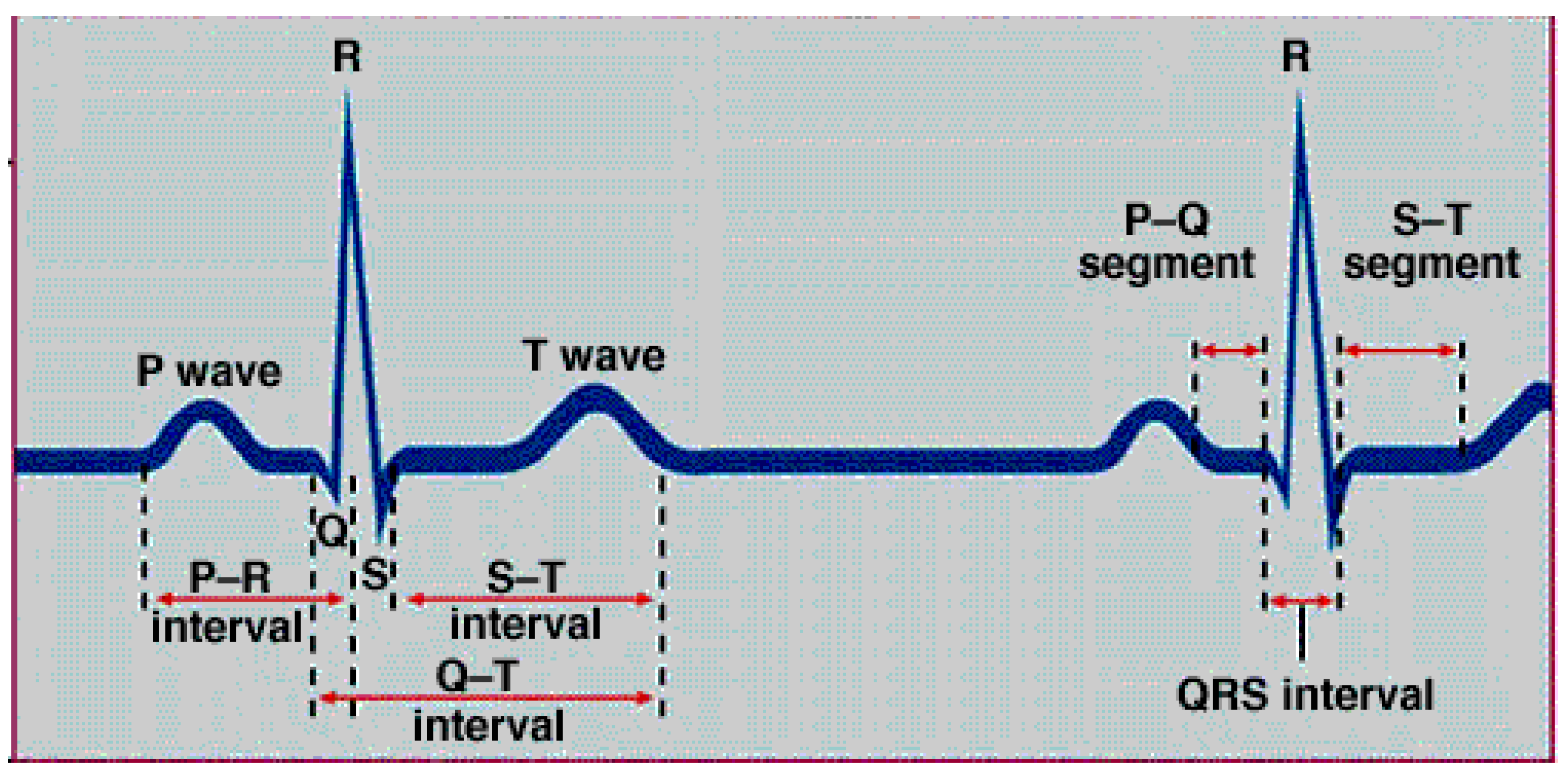 Sensors 22 05327 g003