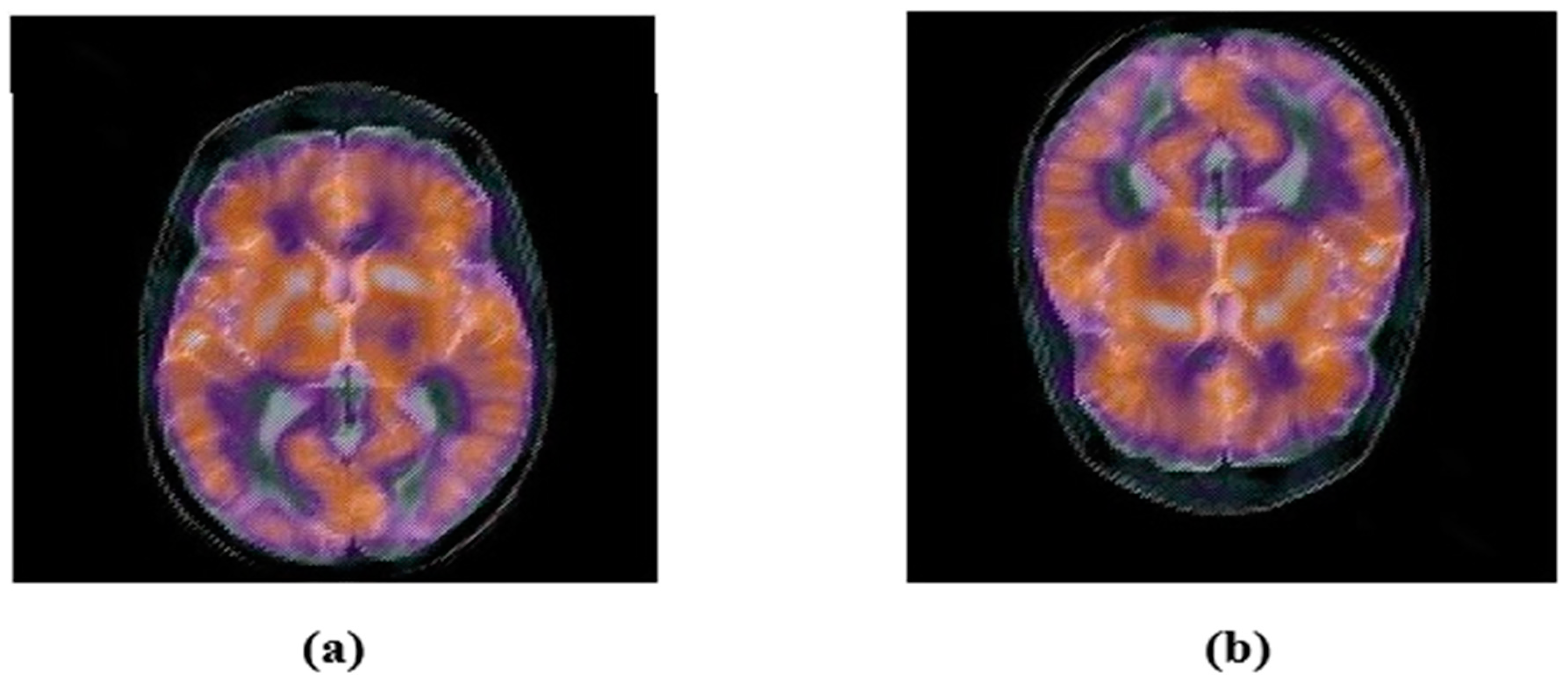 Sensors 22 05612 g011