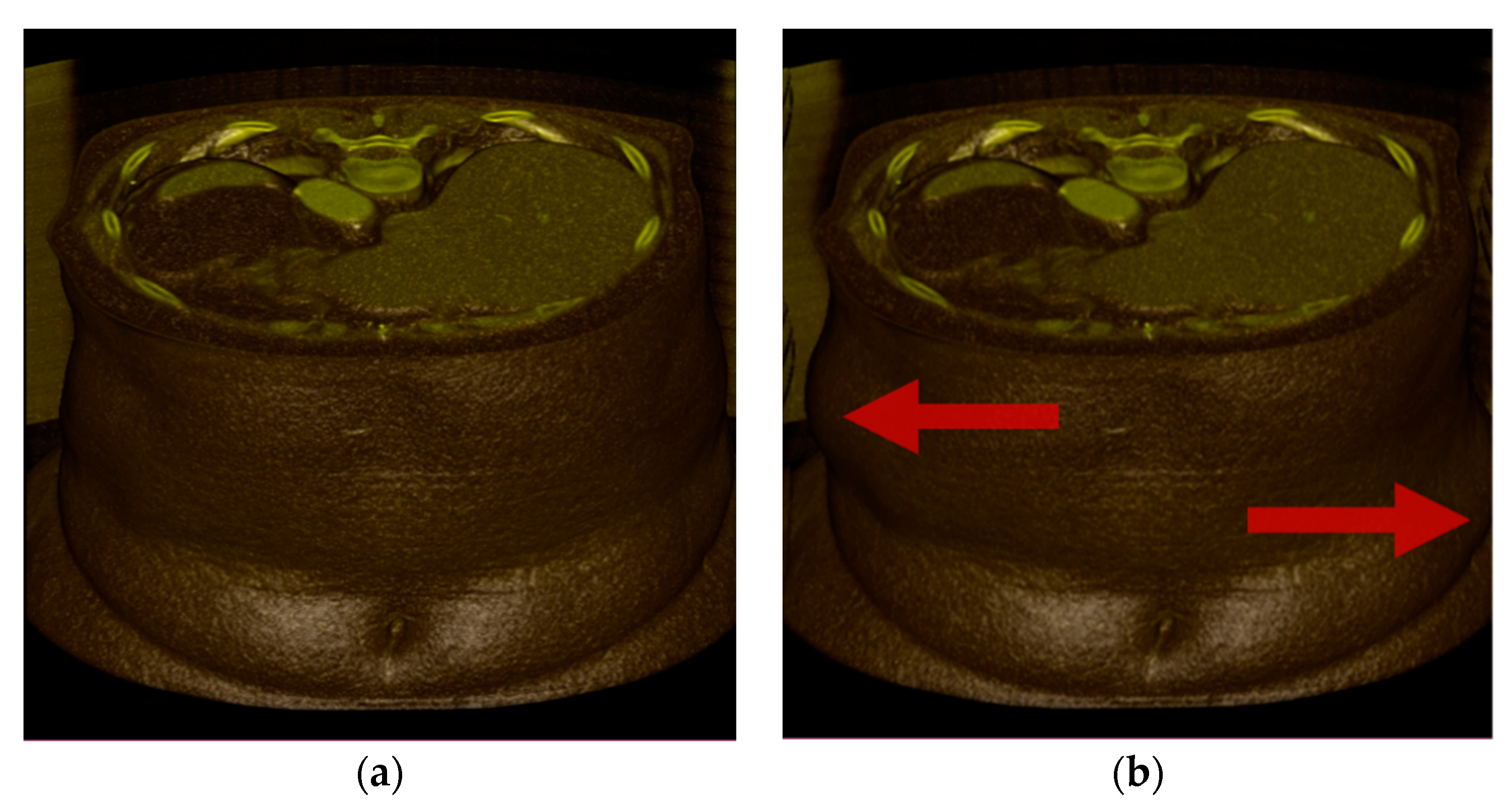 Sensors 22 06276 g007a
