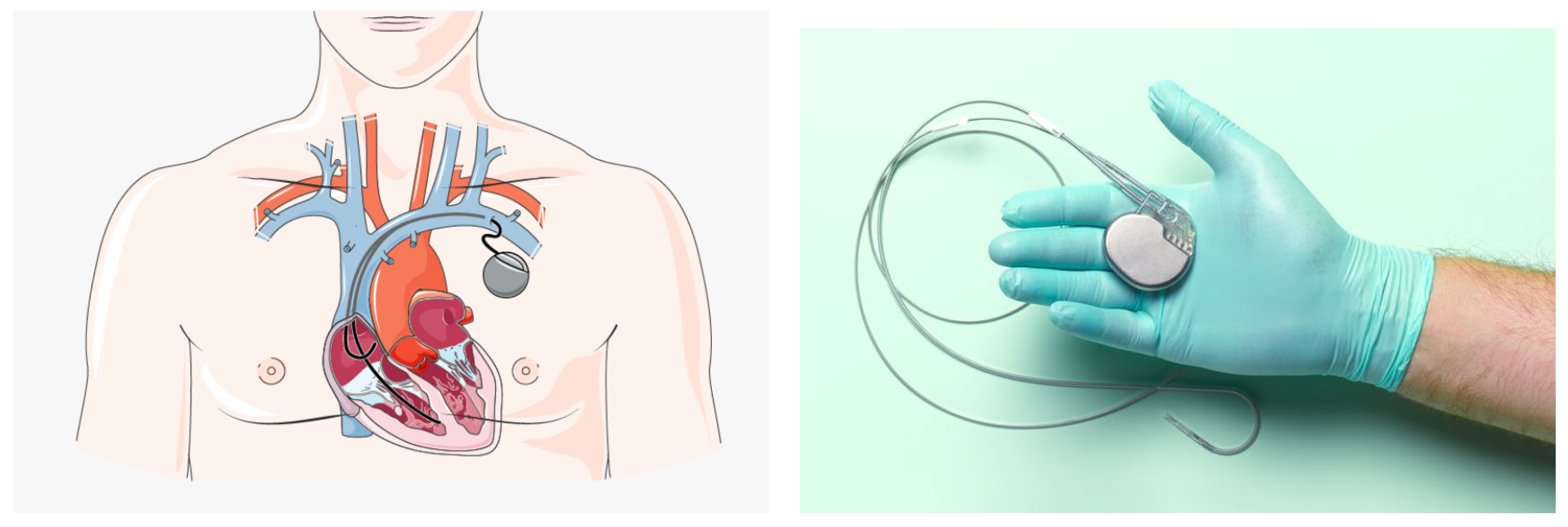 Sensors 22 06359 g001