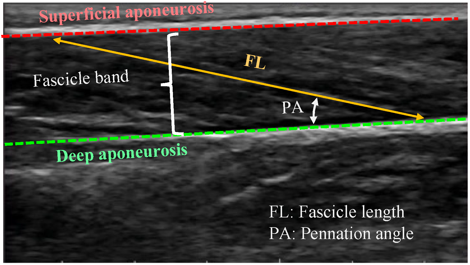 Sensors 22 06498 g001