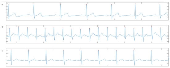Sensors 22 06536 g0a1 550