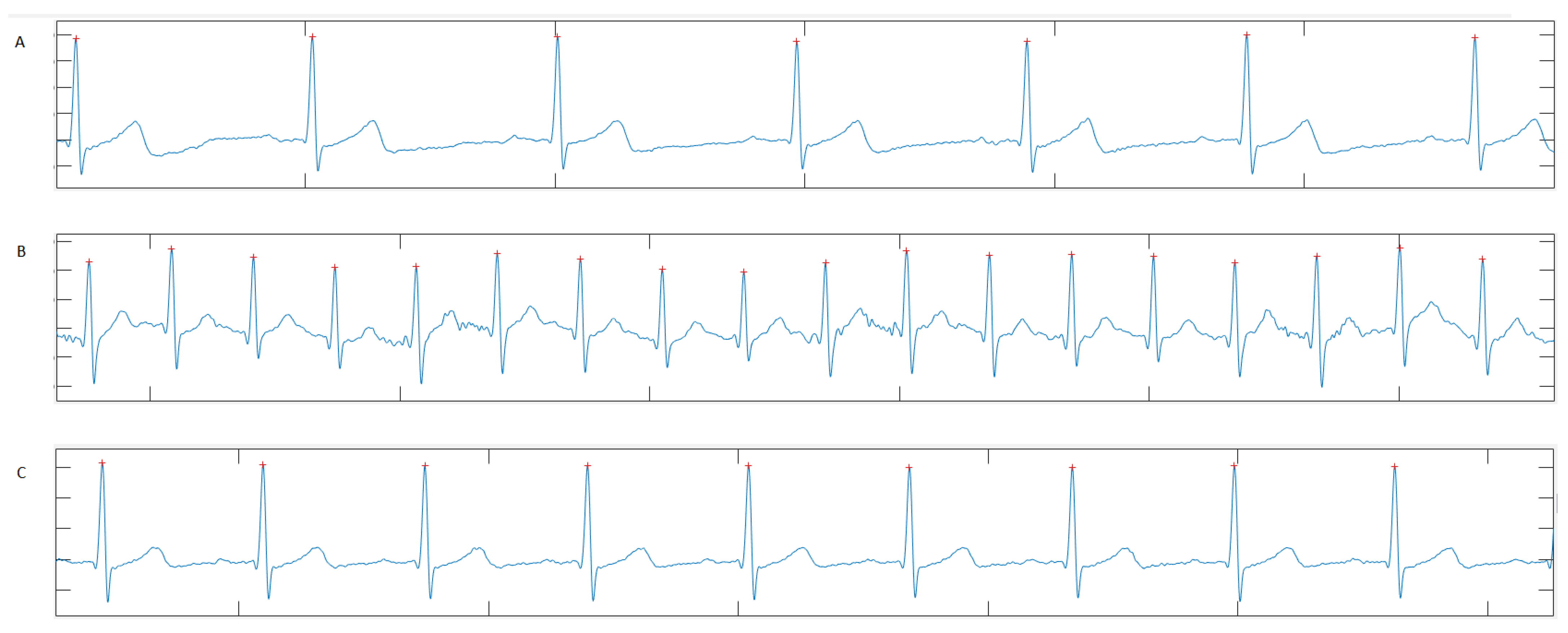 Sensors 22 06536 g0a1