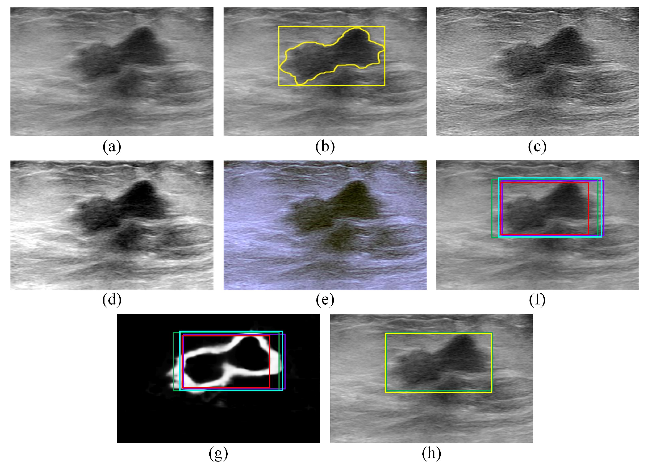 Sensors 22 06721 g004