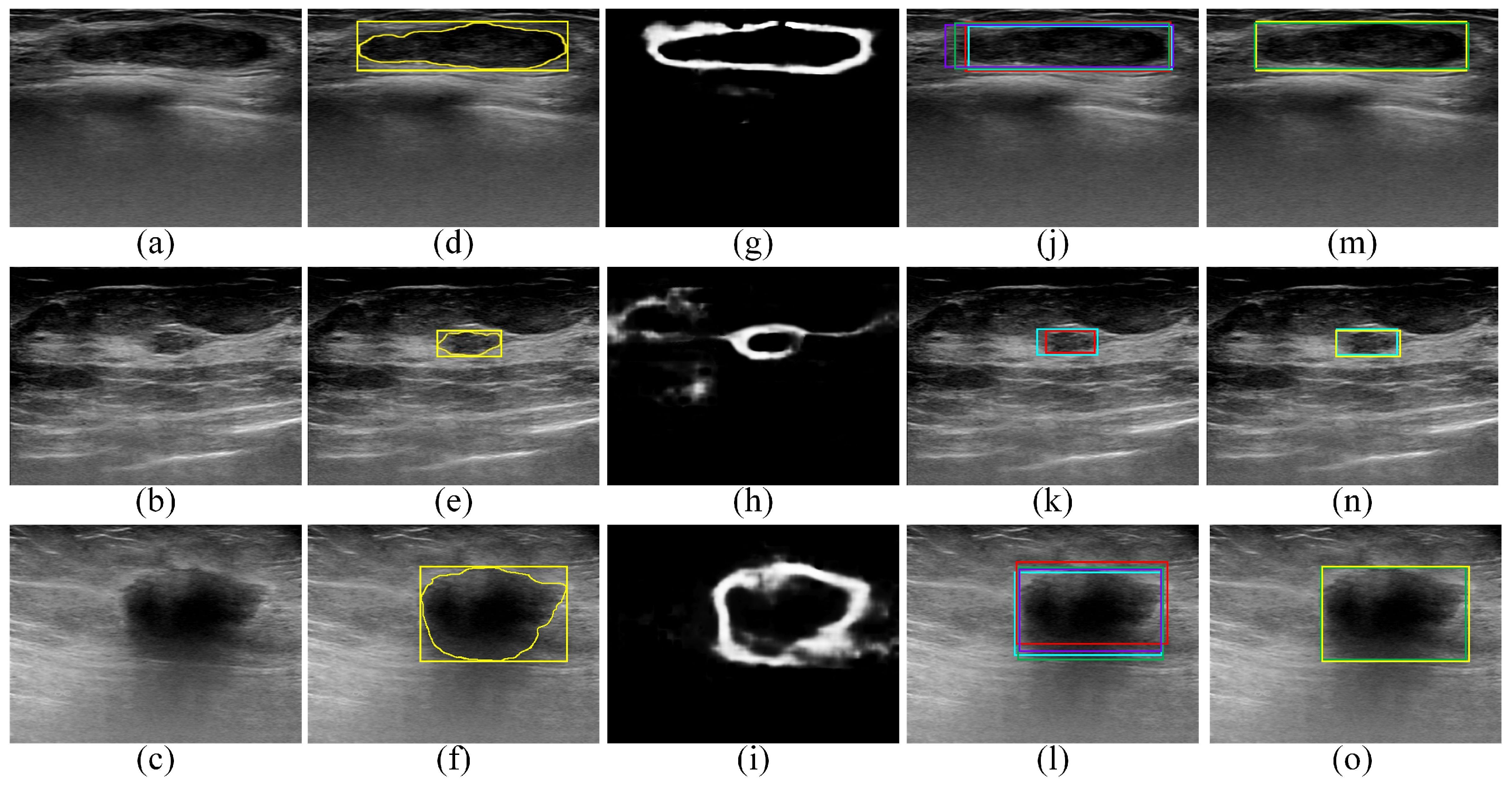 Sensors 22 06721 g005