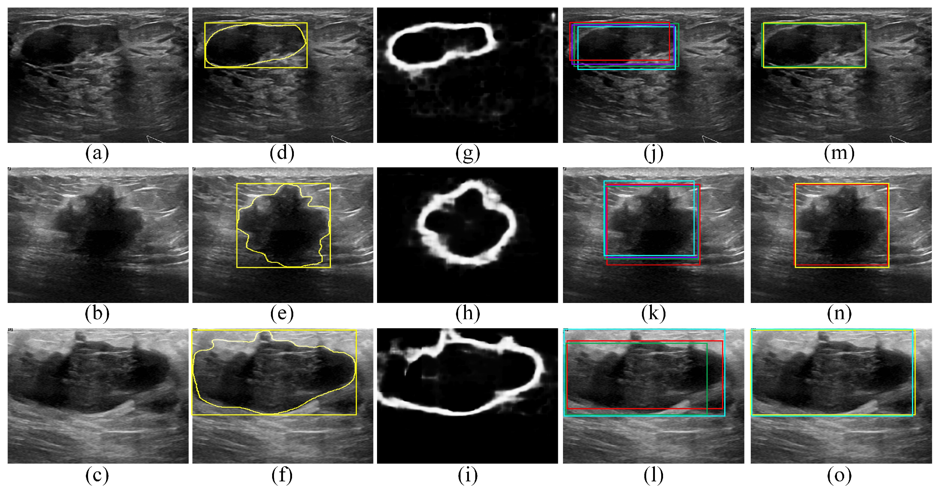 Sensors 22 06721 g006