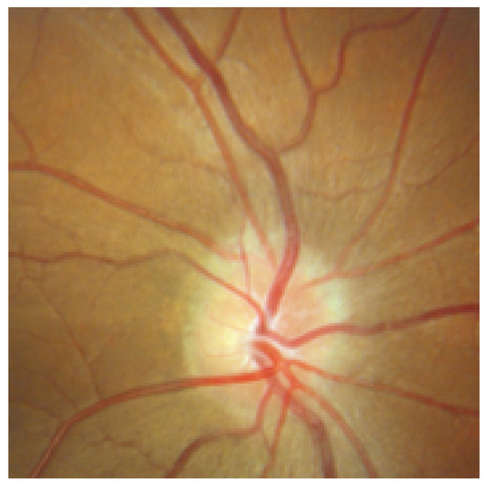 Sensors 22 06899 g011 550