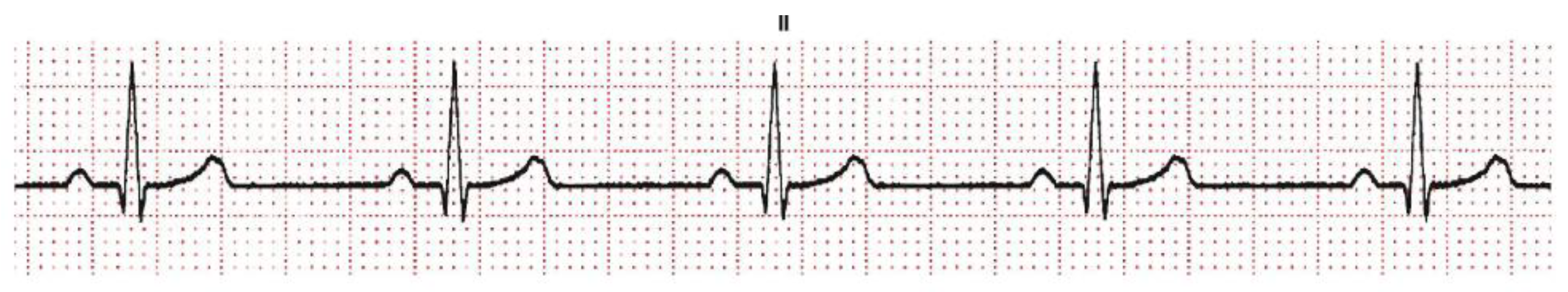 Sensors 22 07138 g004