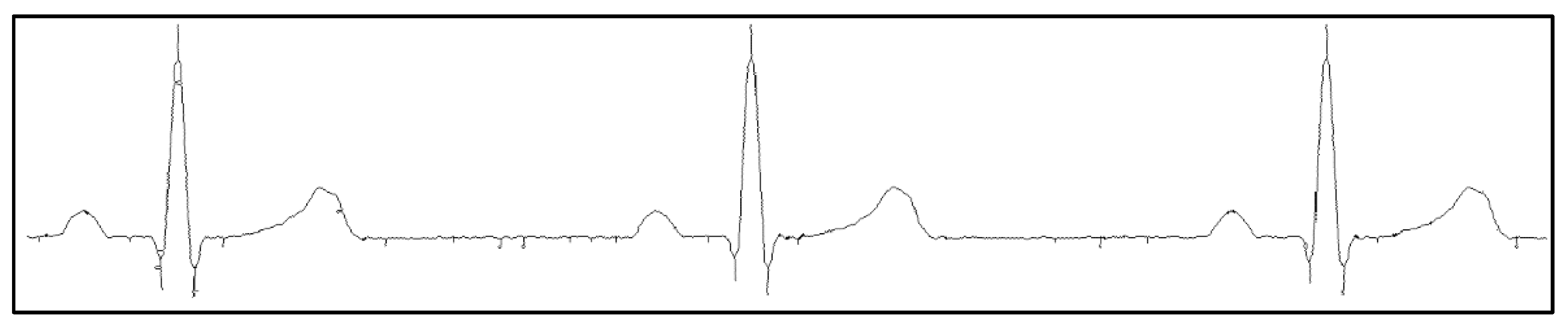 Sensors 22 07138 g006