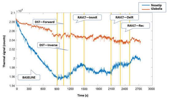 Sensors 22 07300 g0a1