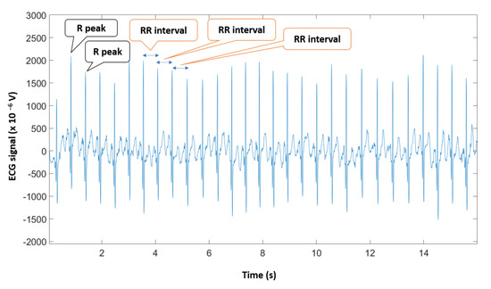 Sensors 22 07300 g0a2