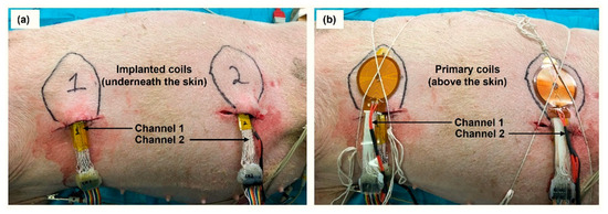 Sensors 22 07775 g004