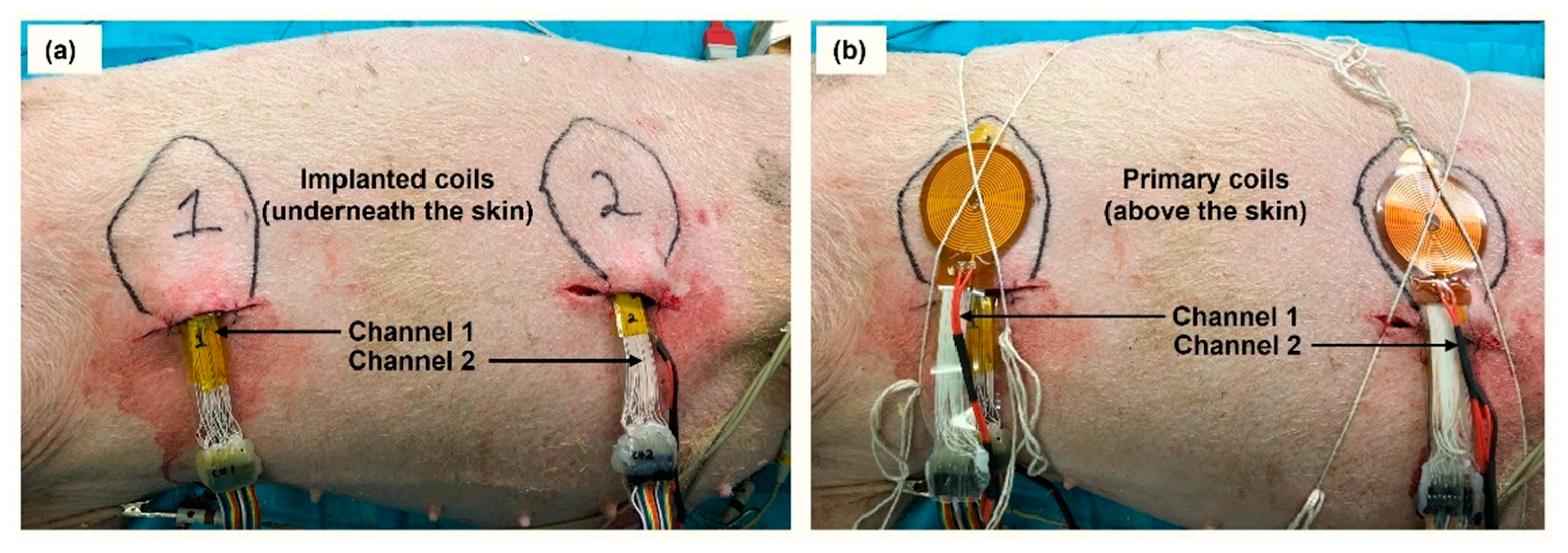 Sensors 22 07775 g004