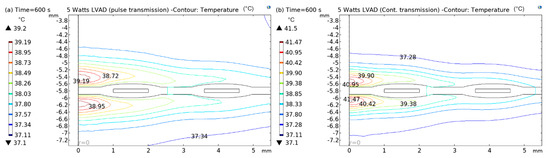 Sensors 22 07775 g014