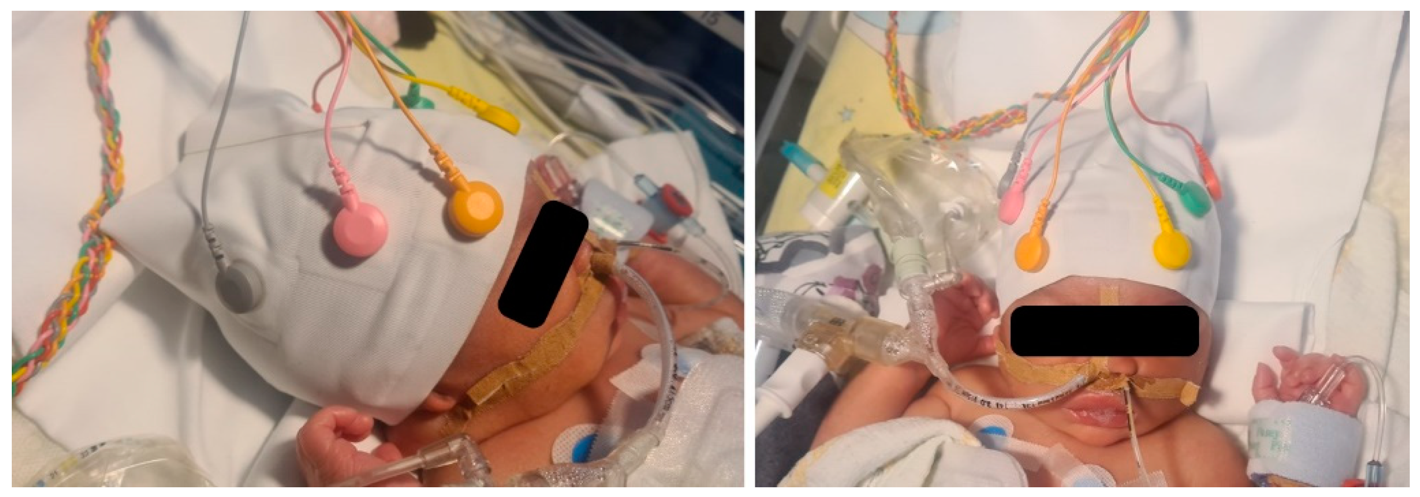 Sensors 22 07869 g004