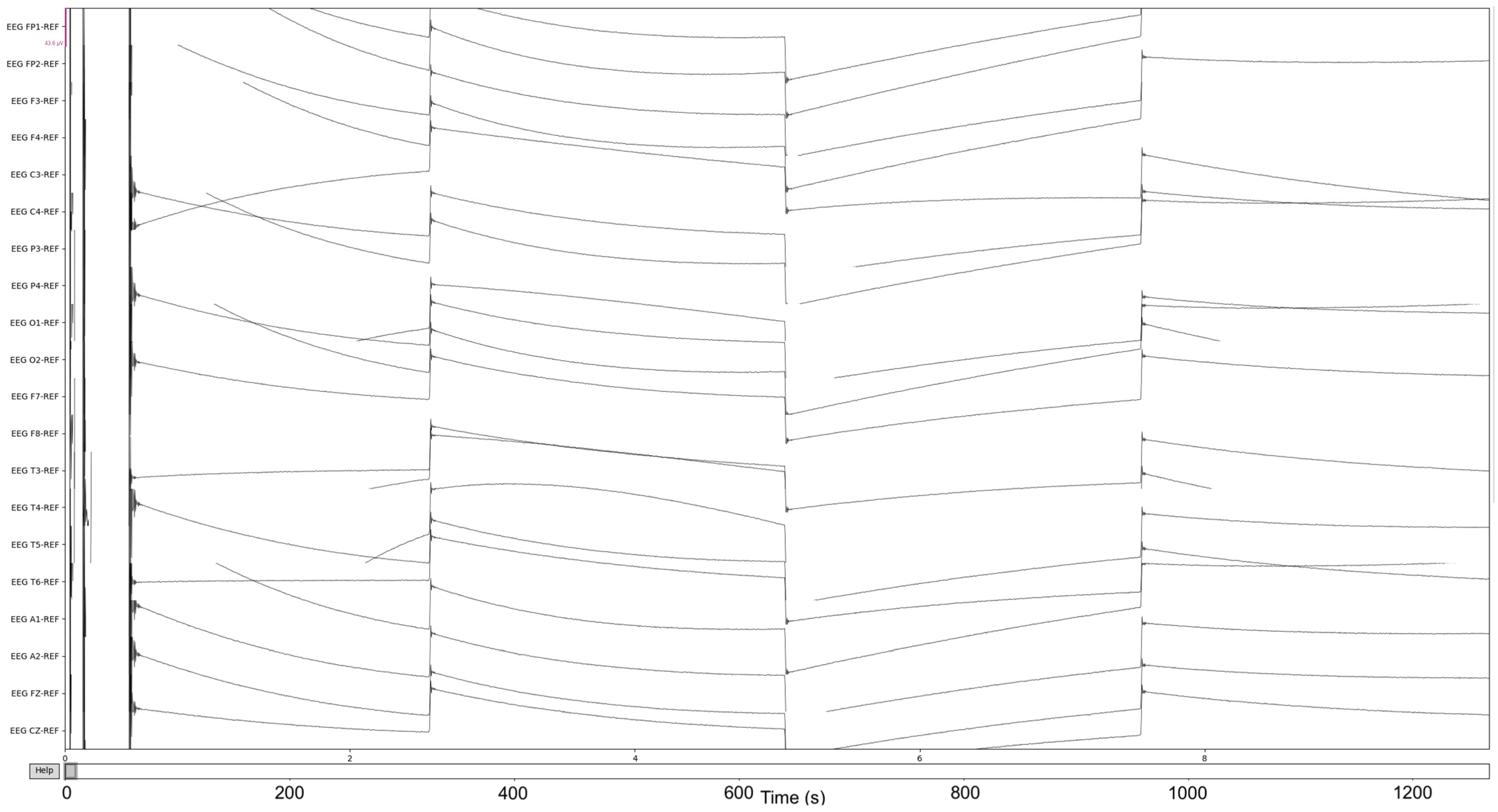 Sensors 22 08112 g004