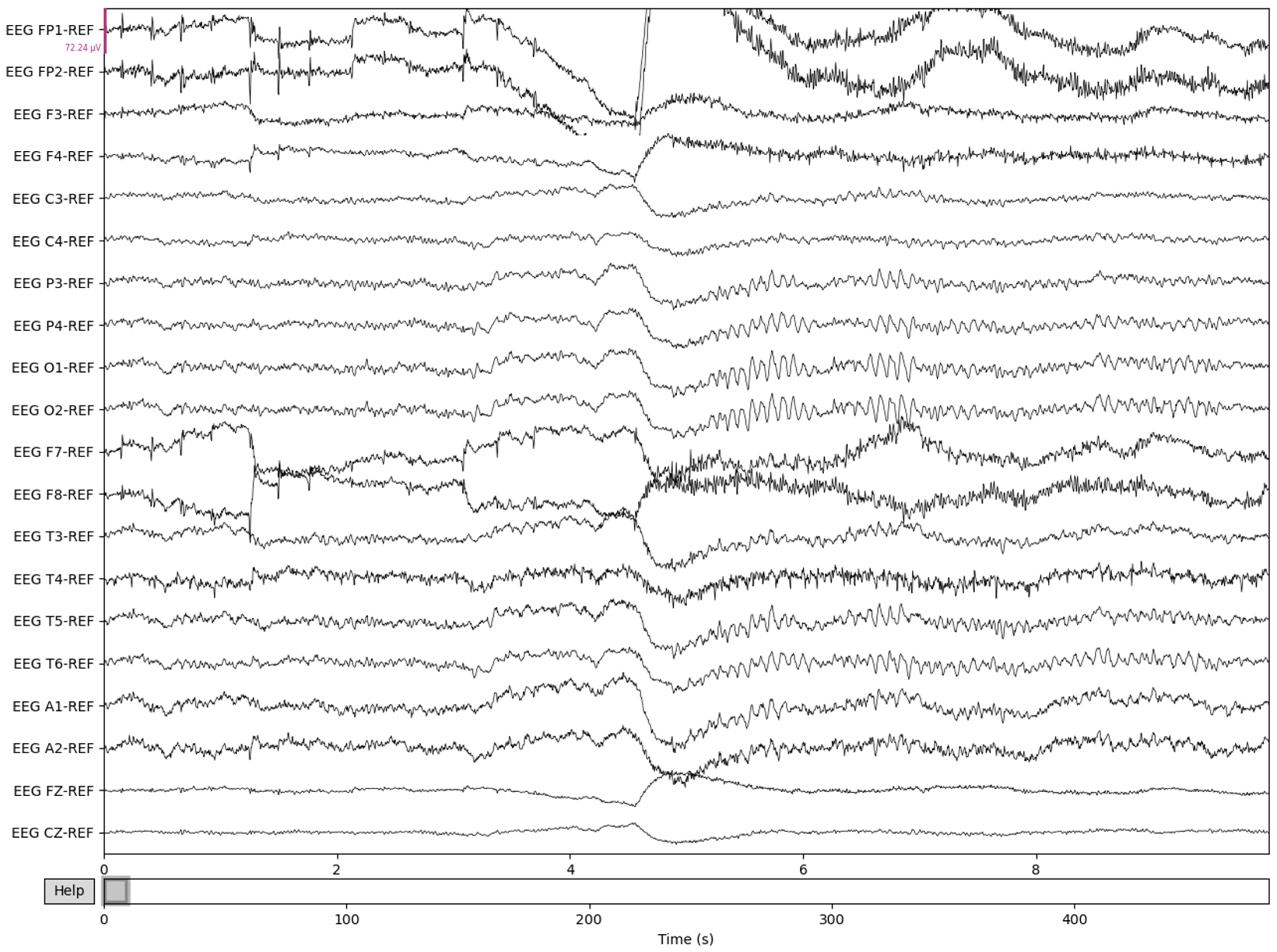 Sensors 22 08112 g005