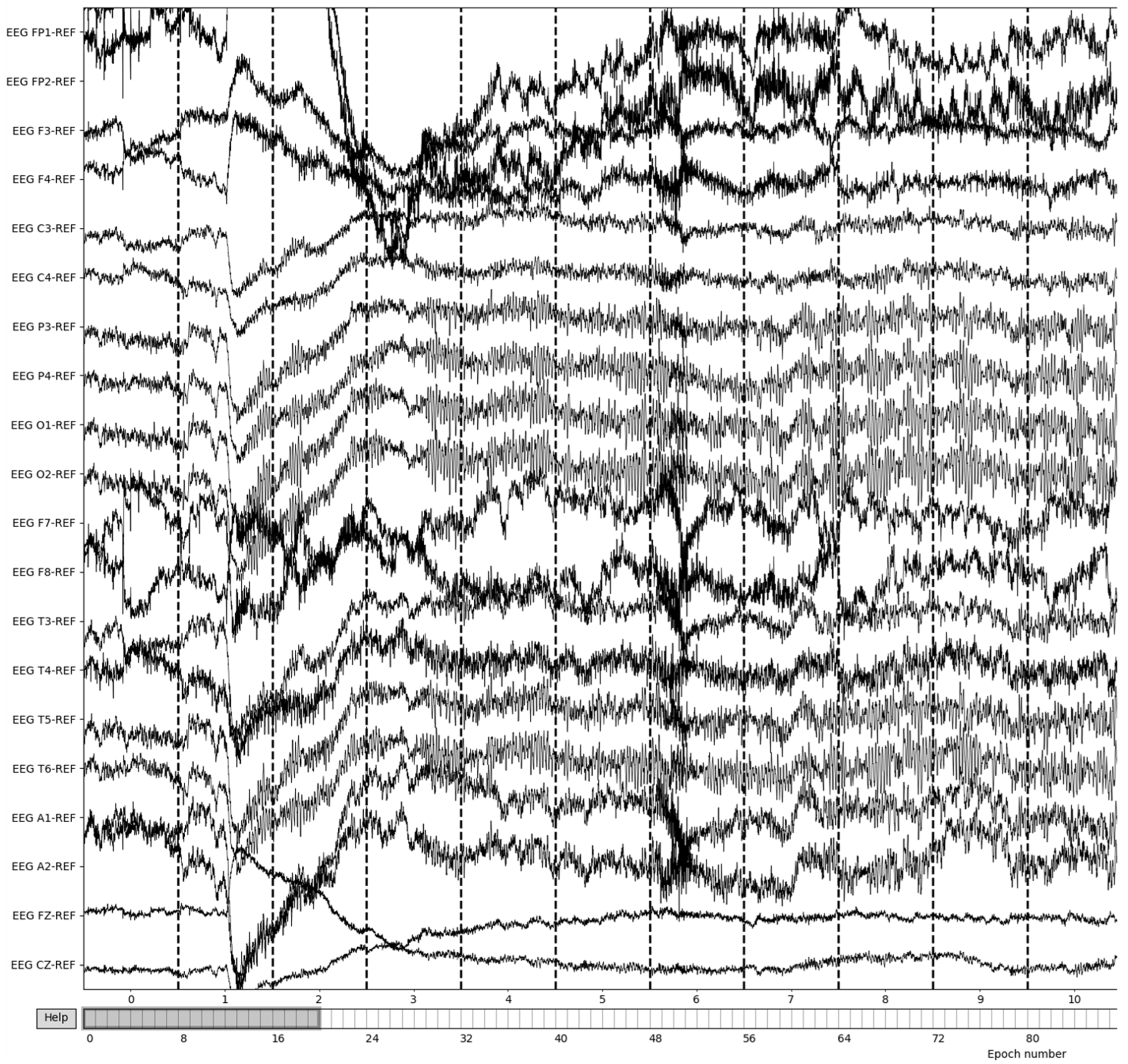 Sensors 22 08112 g006