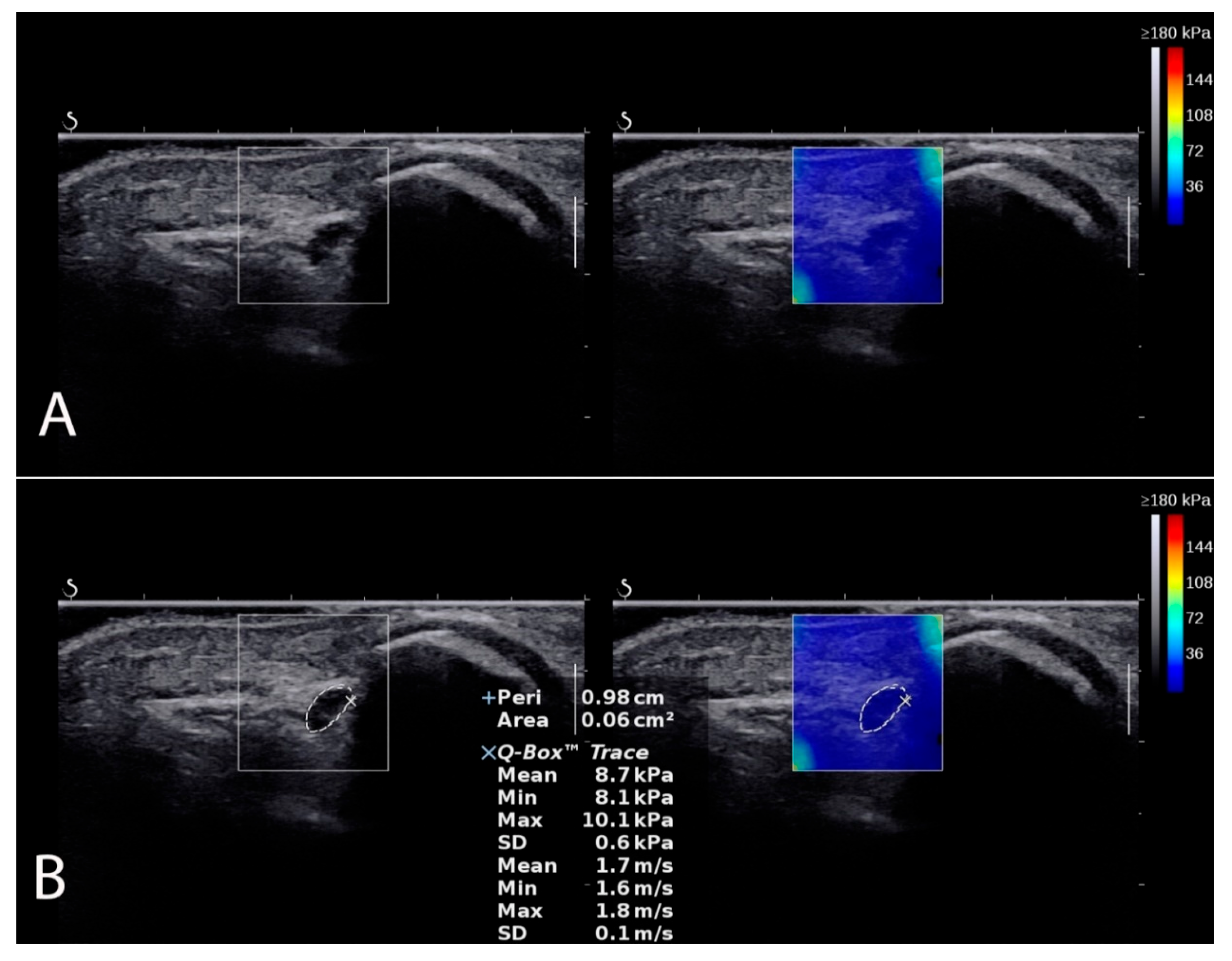 Sensors 22 08354 g002