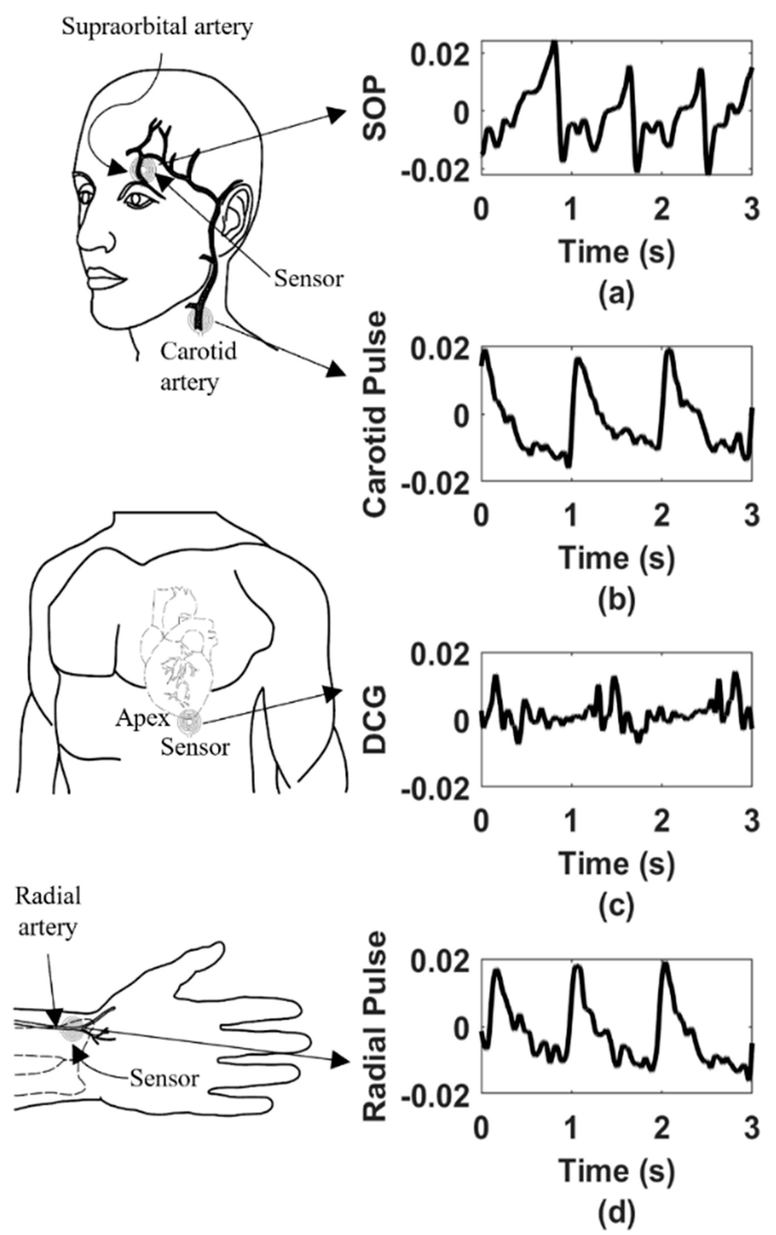 Sensors 22 08389 g011 Sensors 22 08389 g011