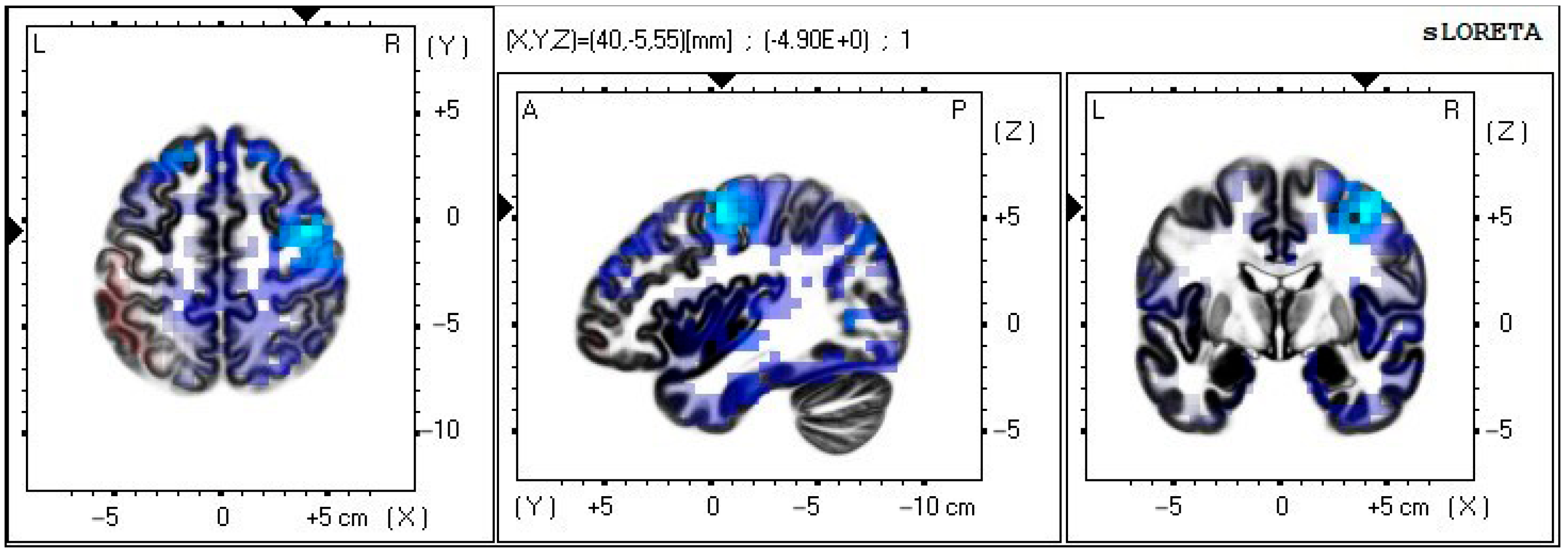 Sensors 22 08491 g009 Sensors 22 08491 g009