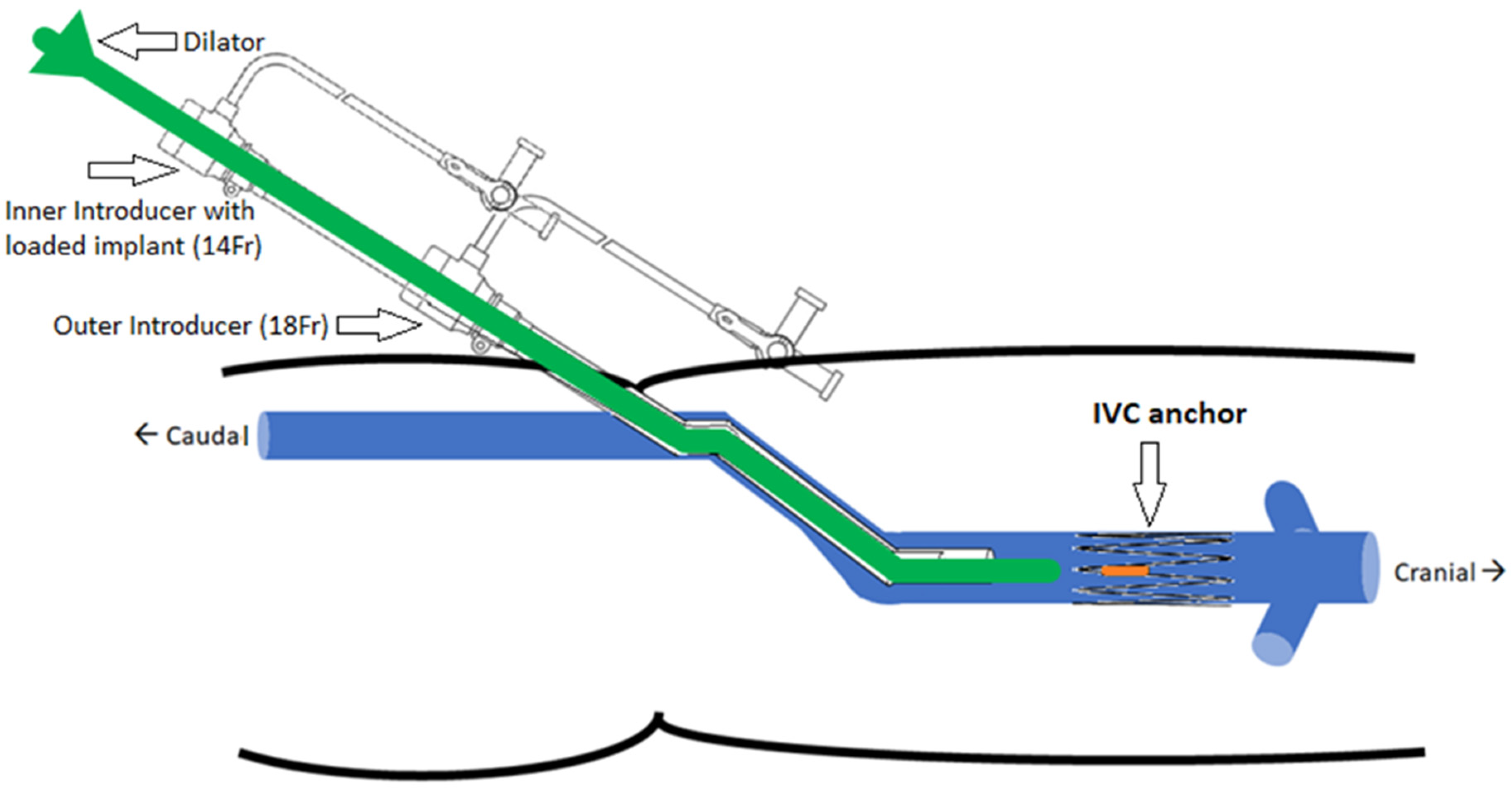 Sensors 22 08552 g005