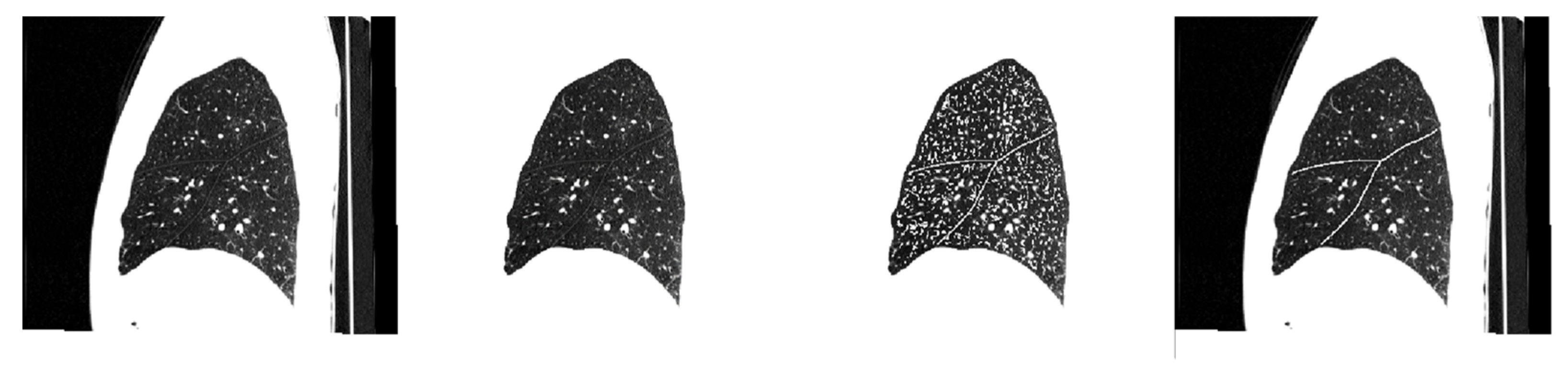 Sensors 22 08560 g003