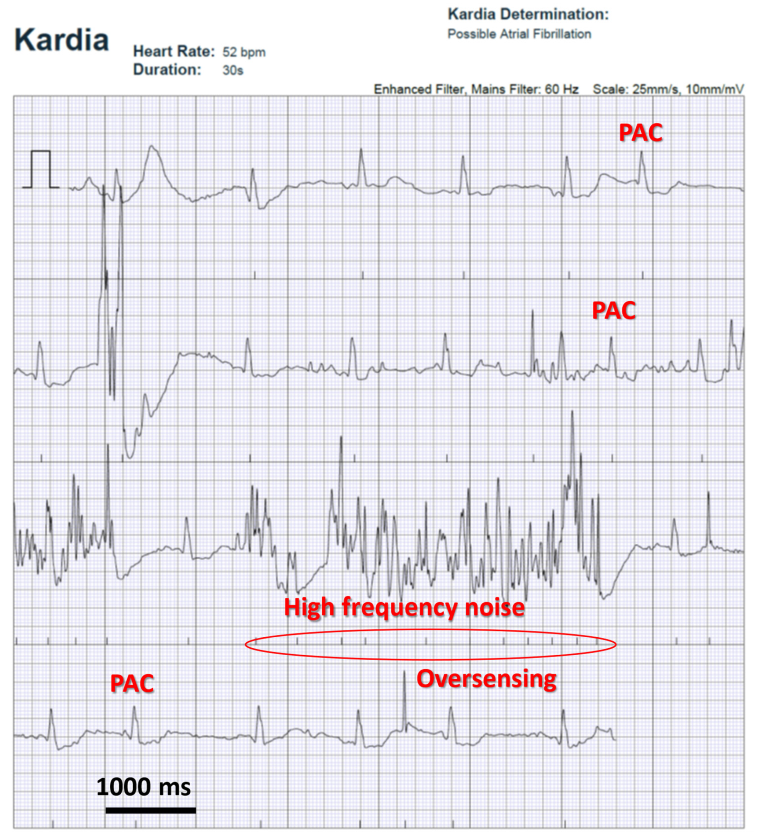 Sensors 22 08903 g002