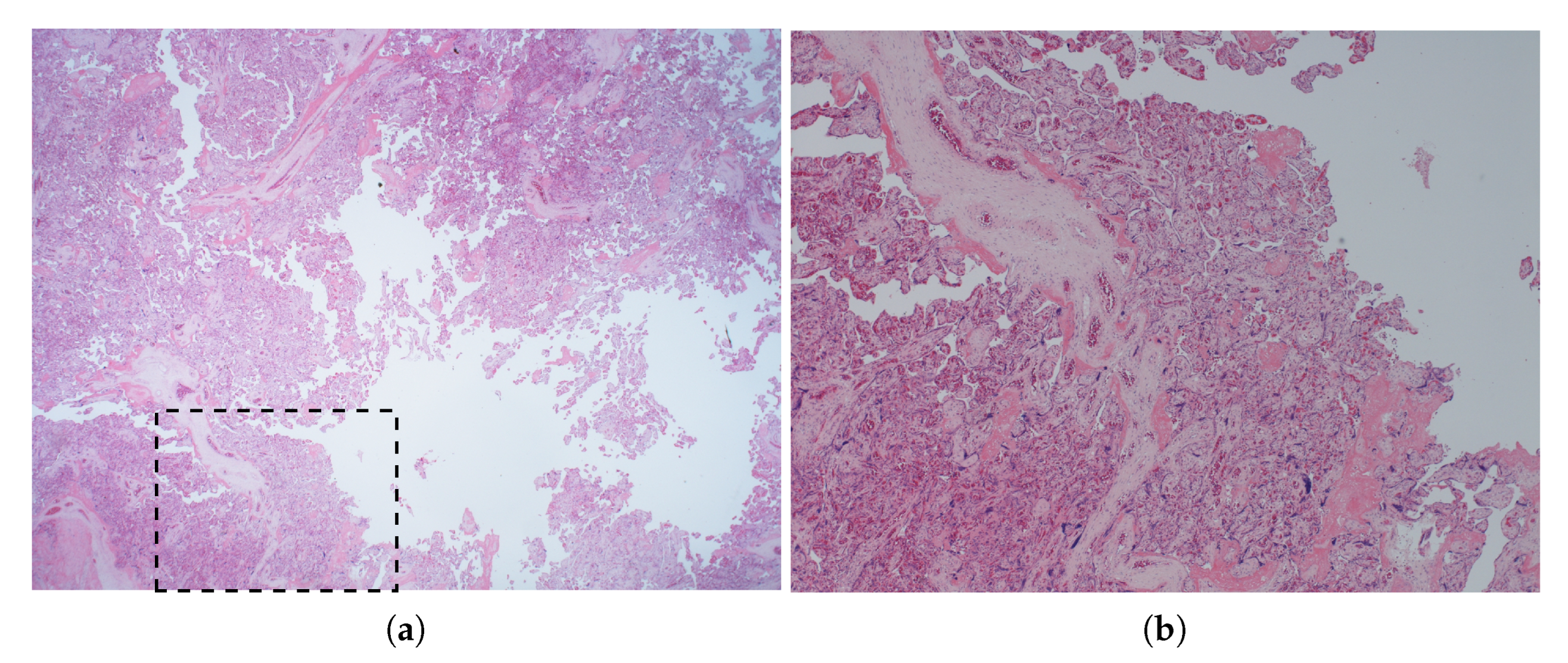 Sensors 22 09035 g014