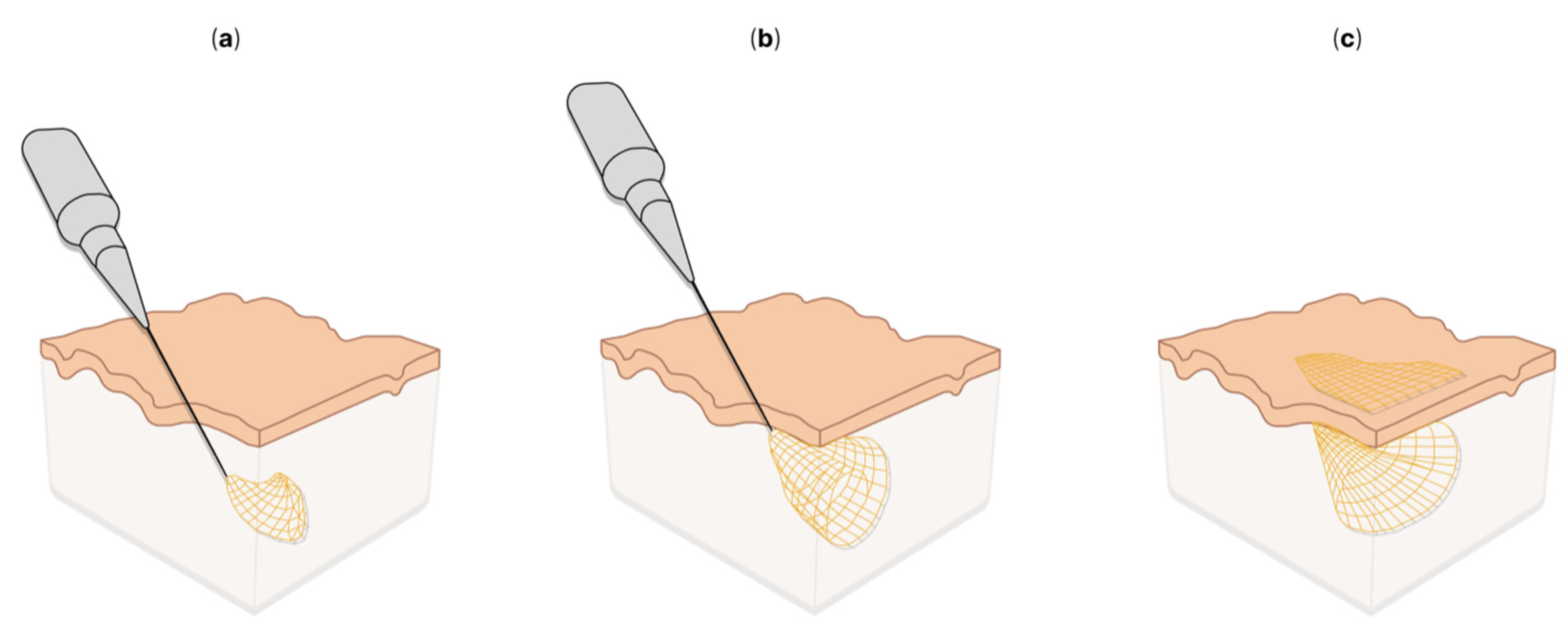 Sensors 22 09085 g005