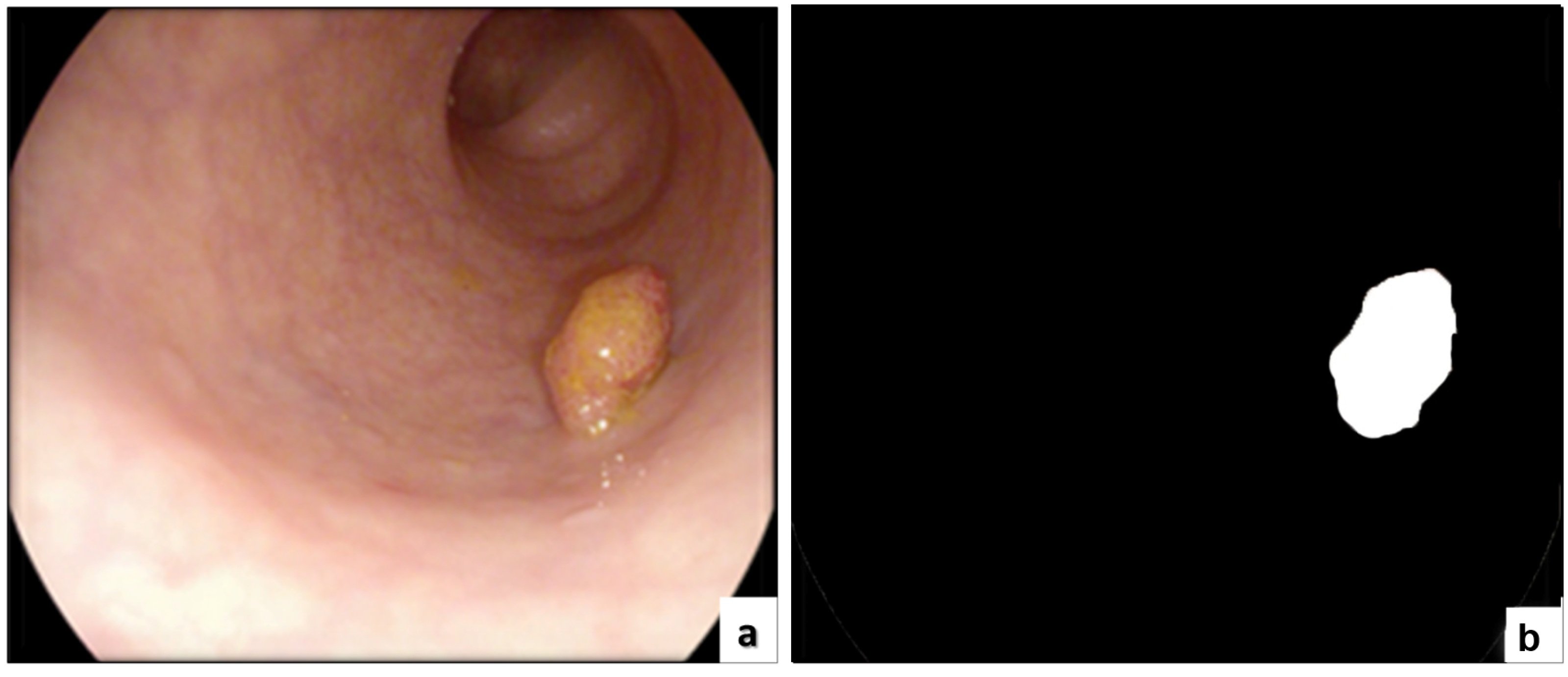Sensors 22 09250 g008