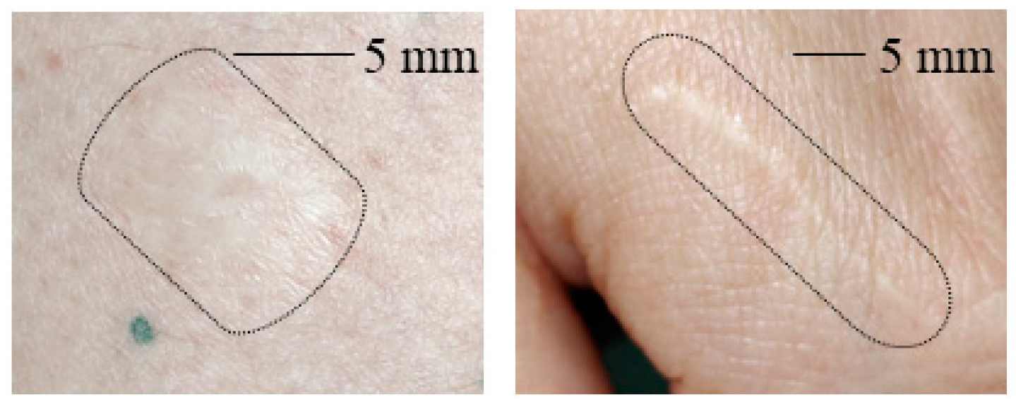 Sensors 22 09349 g003