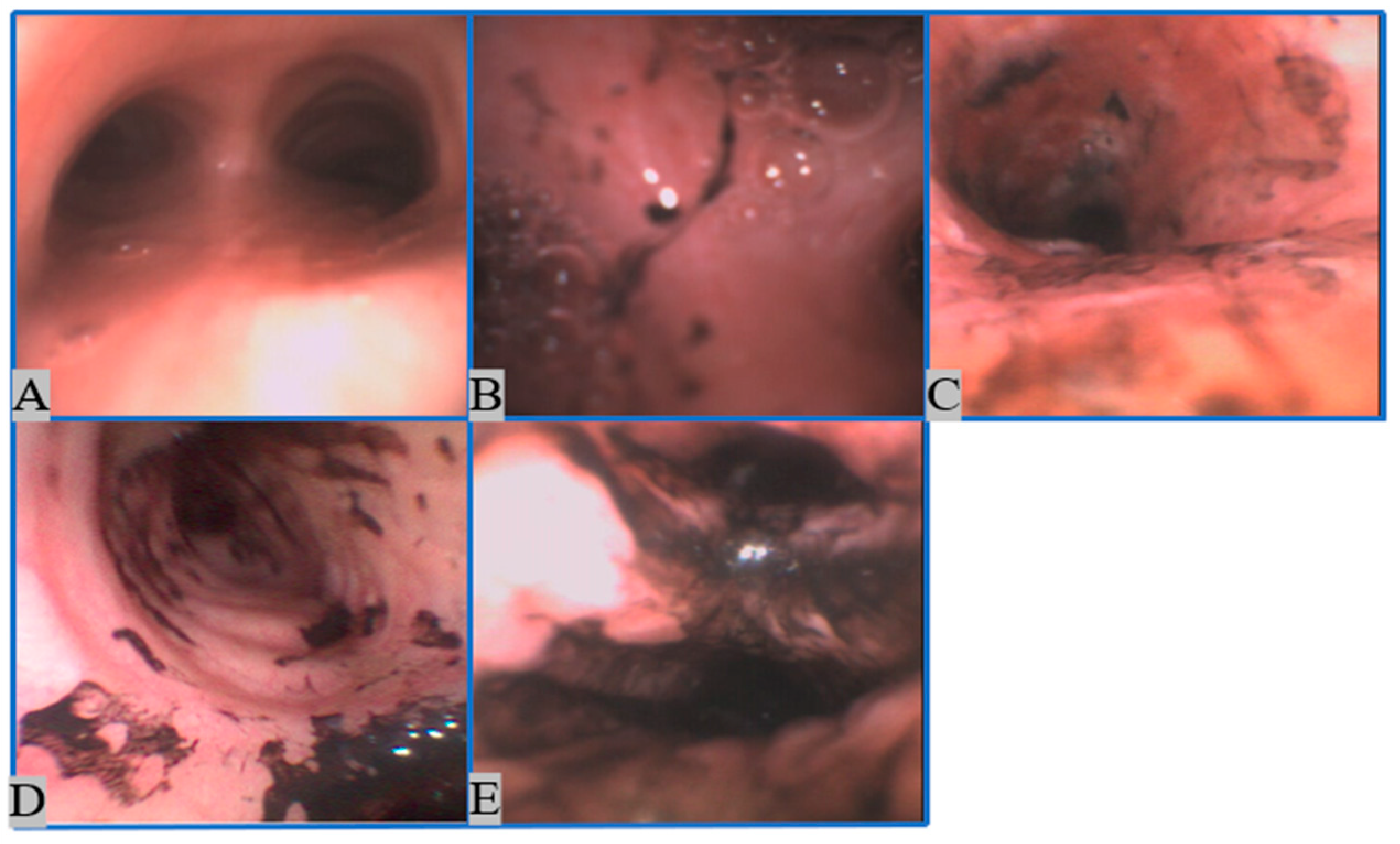 Sensors 22 09430 g001