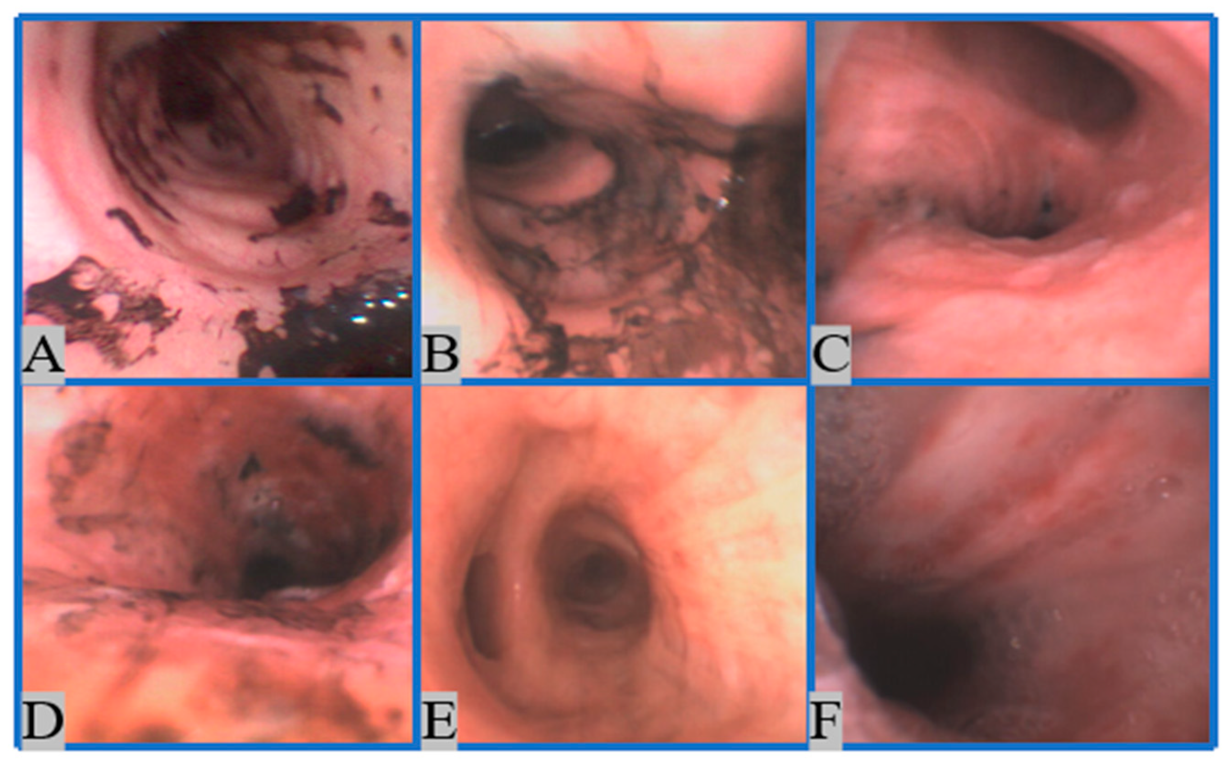 Sensors 22 09430 g003