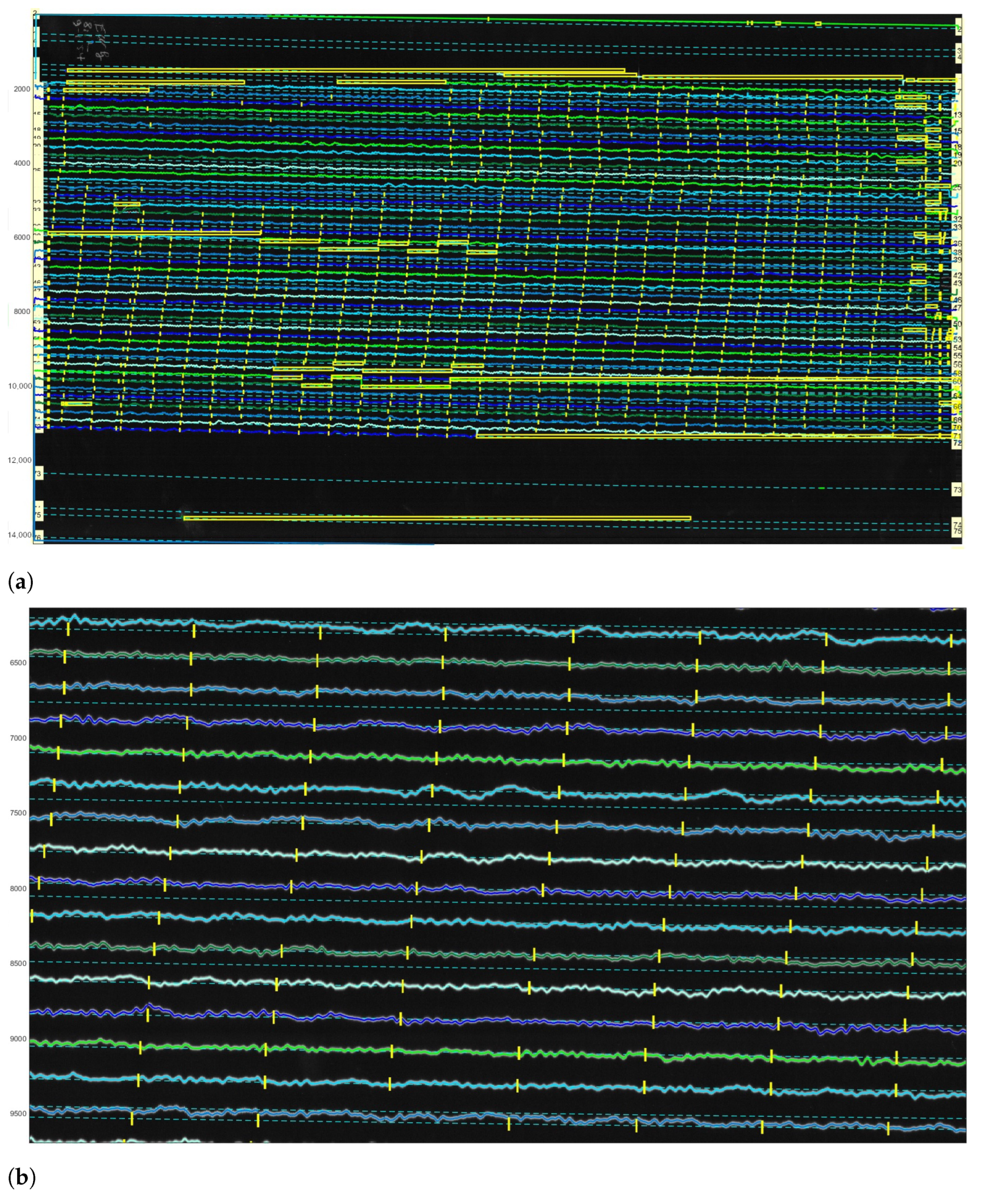 Sensors 23 00056 g012