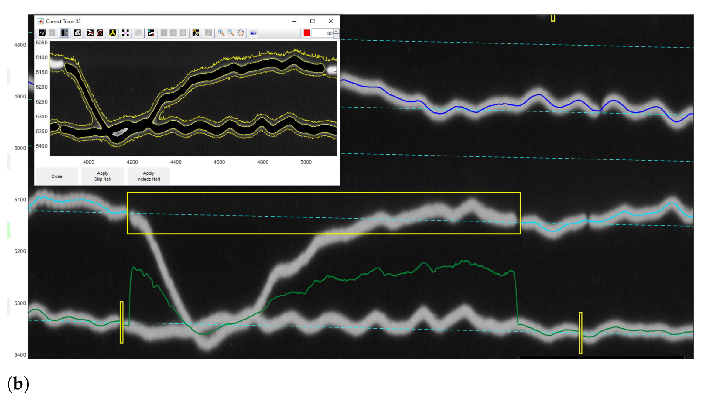 Sensors 23 00056 g014b